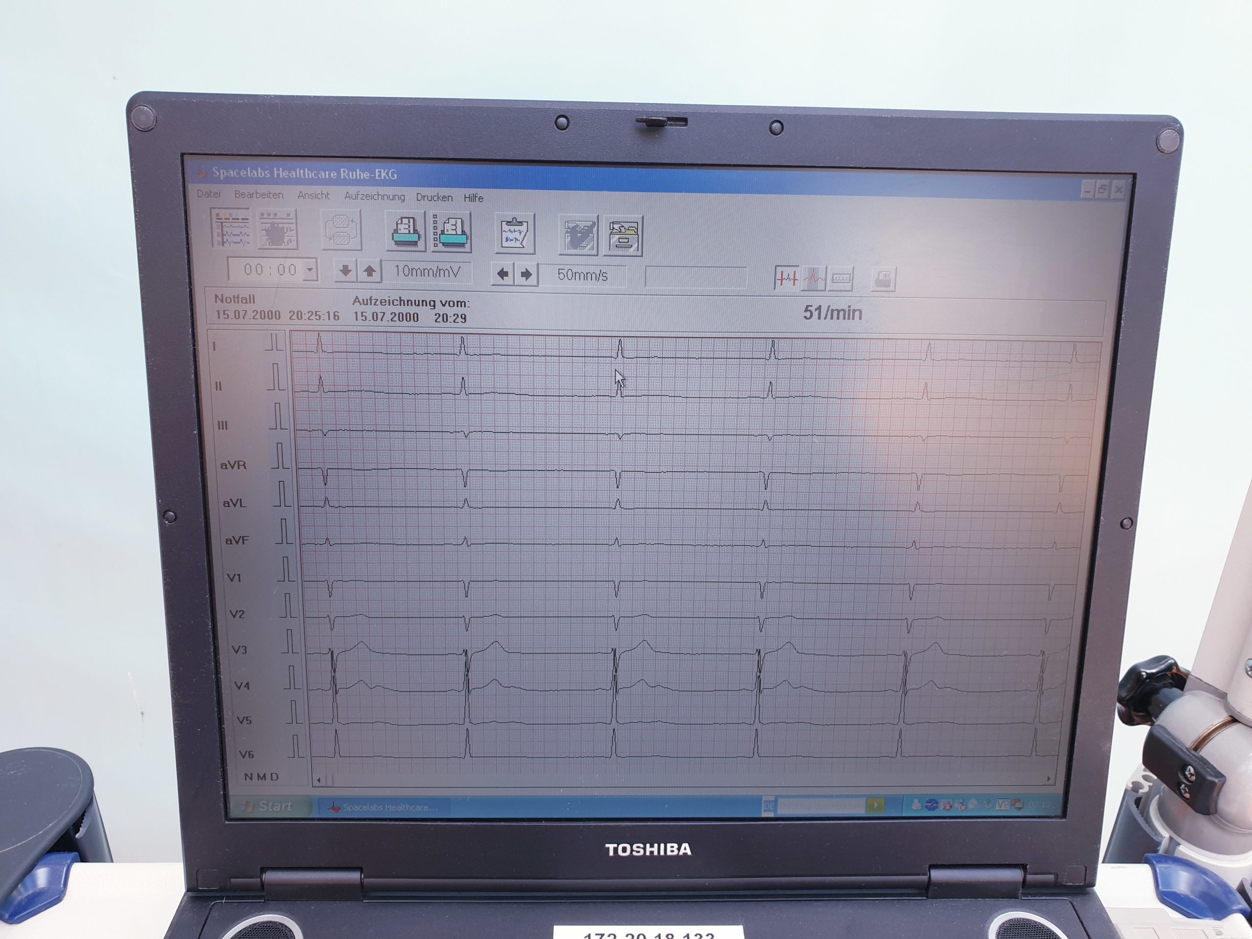 spacelabs cardionavigator EKG MIT DT 100 SAUGANLAGE + CARDIOCOLLECT 12 EKG GERÄT thumbnail 7
