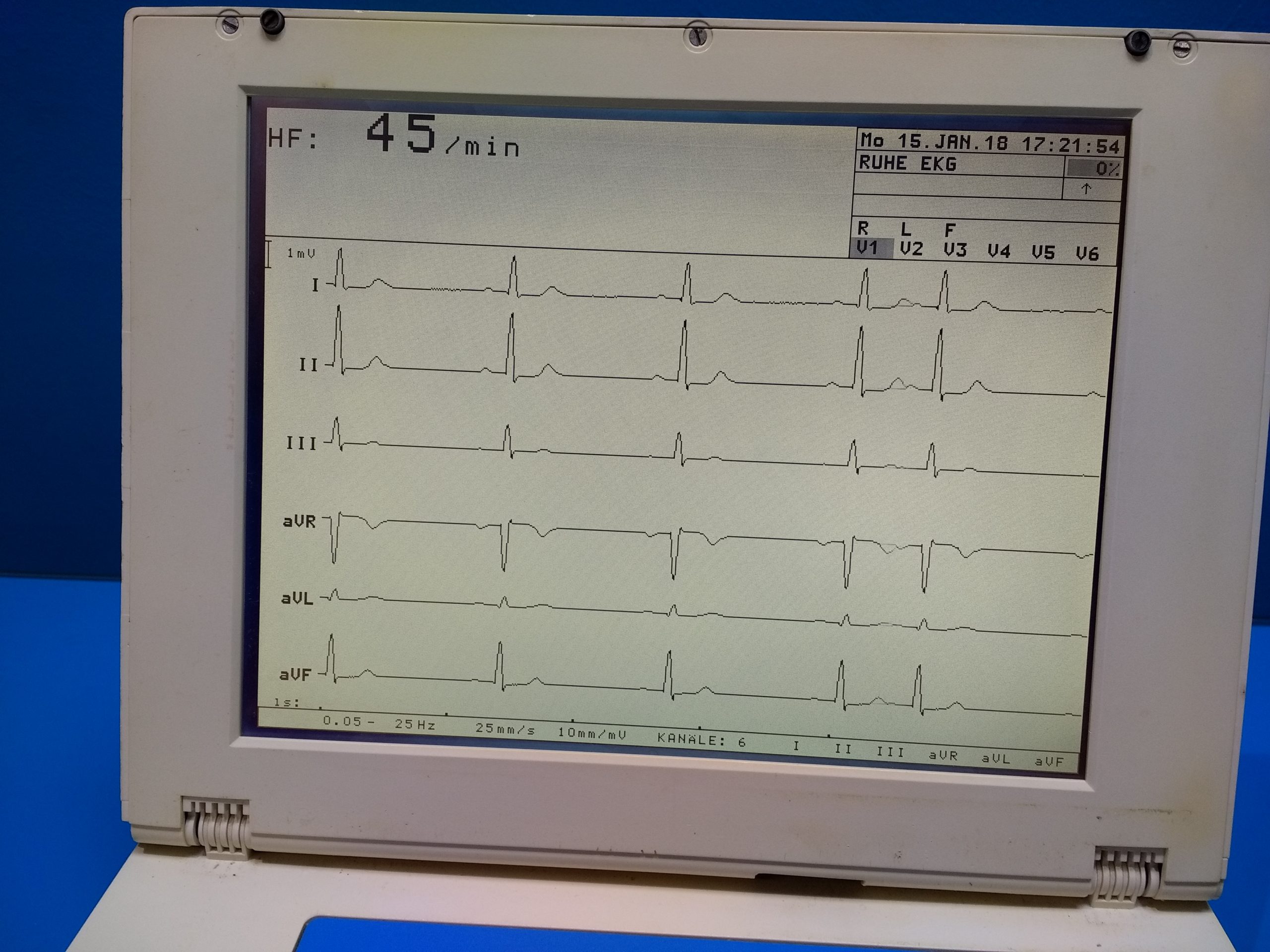 Schiller Cardiovit AT-5 // AT5 // AT 5 EKG Gerät thumbnail 2