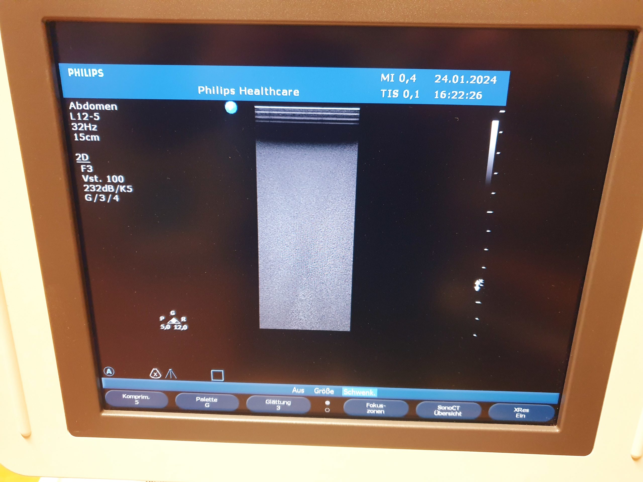 Philips L12-5 Linear Sonde – Probe thumbnail 2