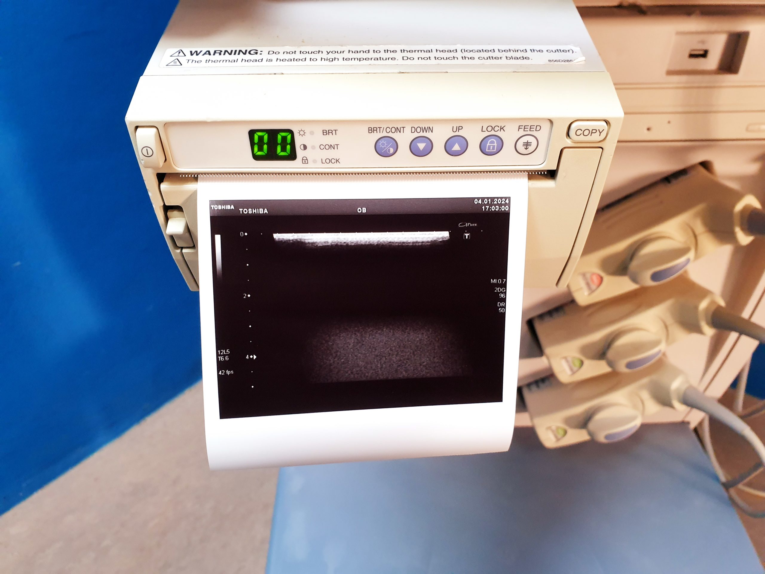 Toshiba Xario SSA-660A + PLT-805AT + PVT-375BT + PST-30BT thumbnail 6