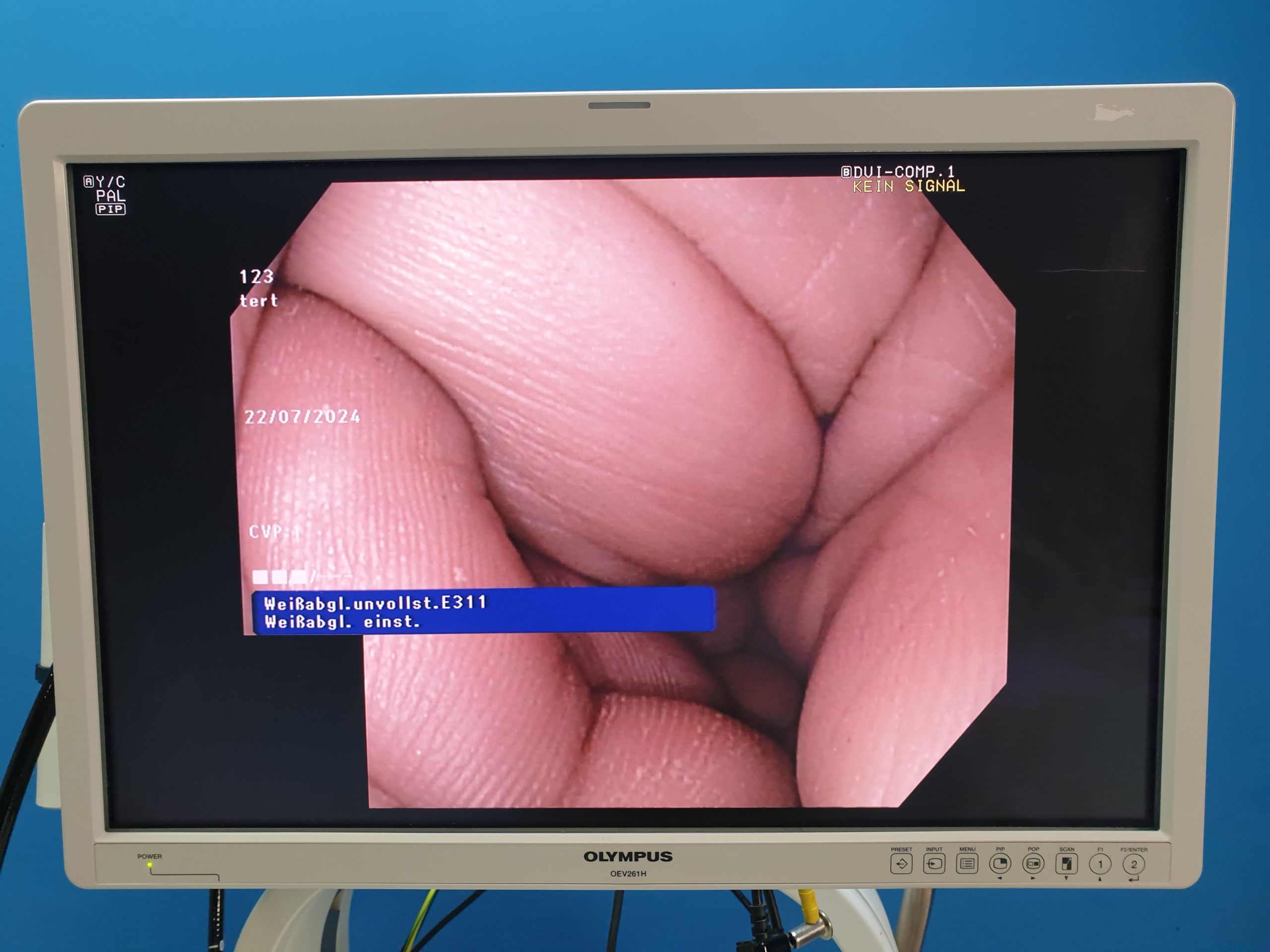 Olympus GIF-1TH190 Gastroskop – Videogastroskop – Refurbished thumbnail 13