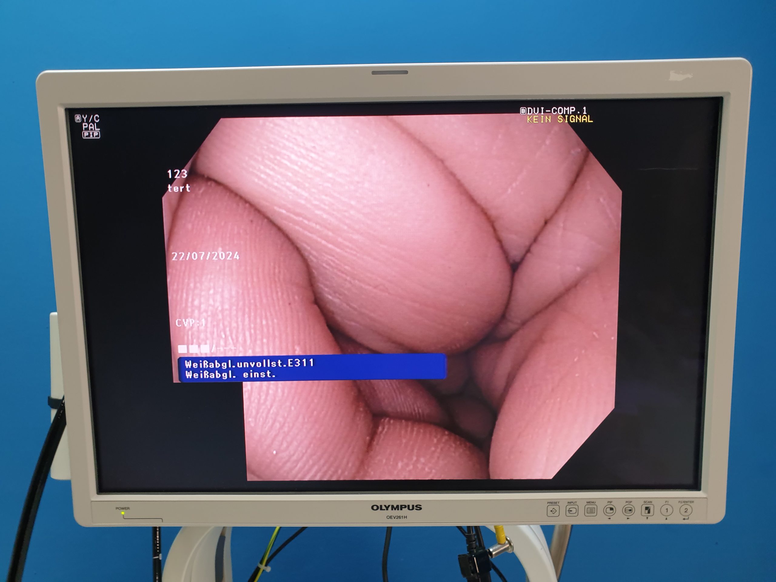 Olympus GIF-1TH190 Gastroskop – Videogastroskop – Refurbished thumbnail 14