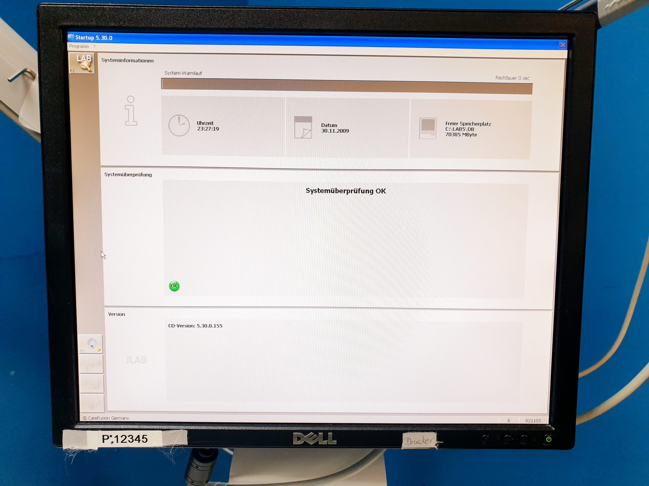 Vyaire Jaeger – MS-CPX Lungenfunktionstest MasterScreen-CPX PFT System Labmanager V5.30.0 thumbnail 4