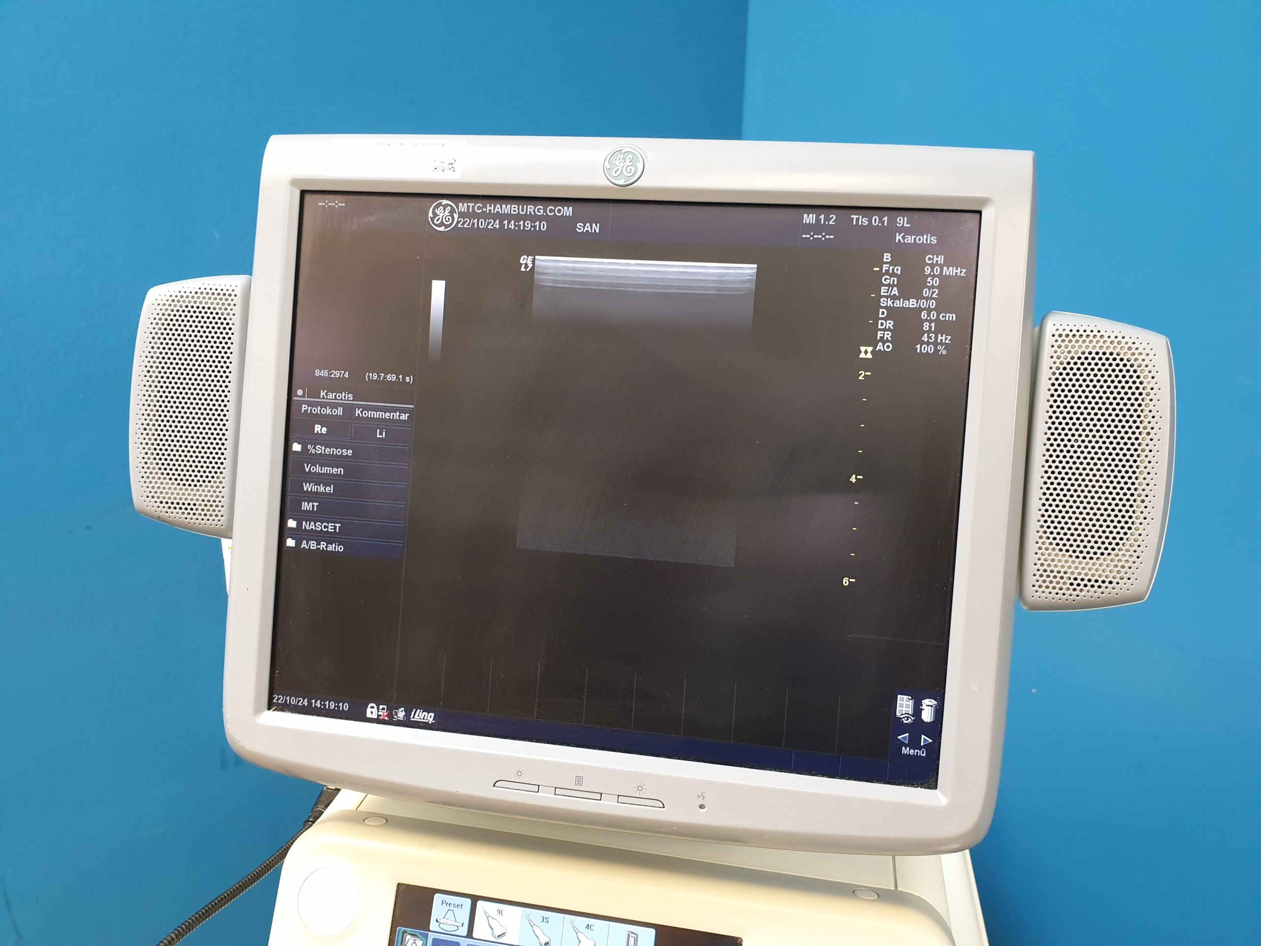 GE Logiq 7 + 4C +3S + 9L Farbdoppler thumbnail 6