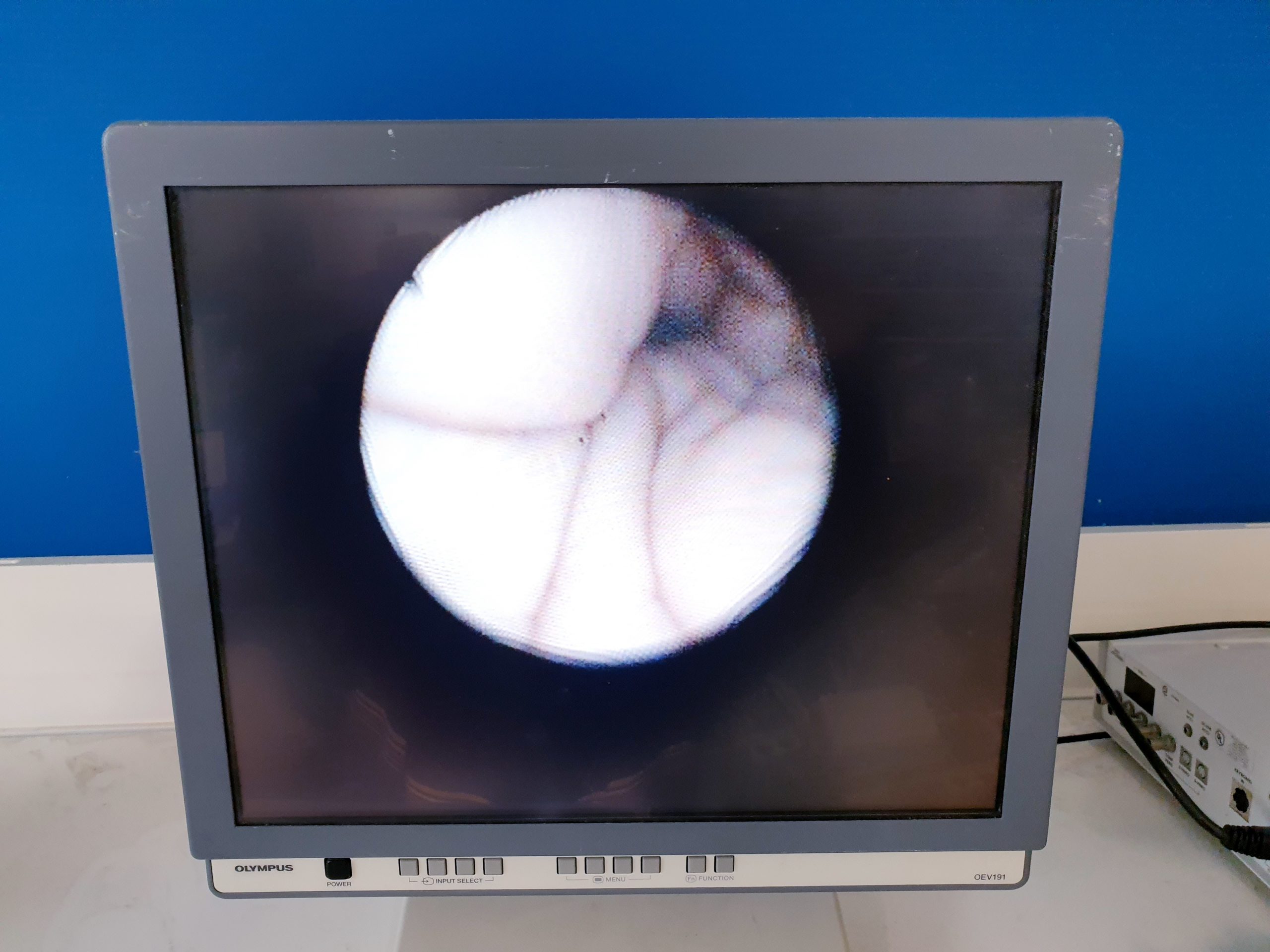 Karl Storz 11302BD2 Flexibles Glasfaser Intubation thumbnail 4