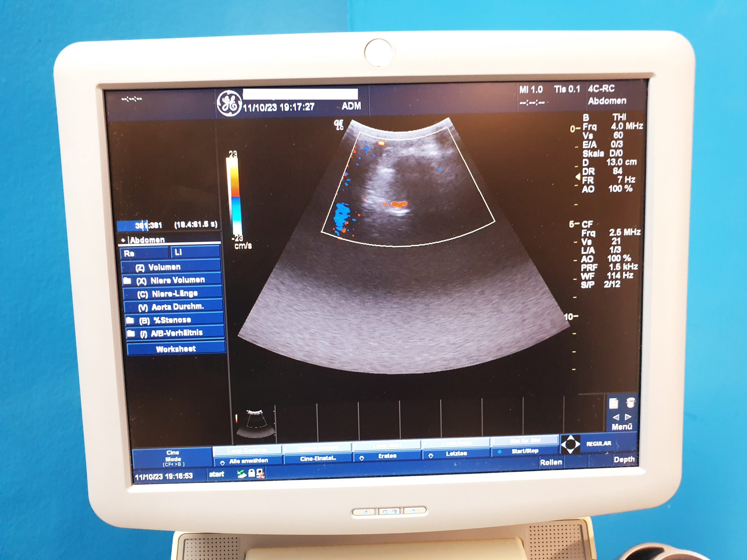 GE Logiq C5 Premium 4C-RS + 7.5L-RS Farbdoppler – Doppler thumbnail 5