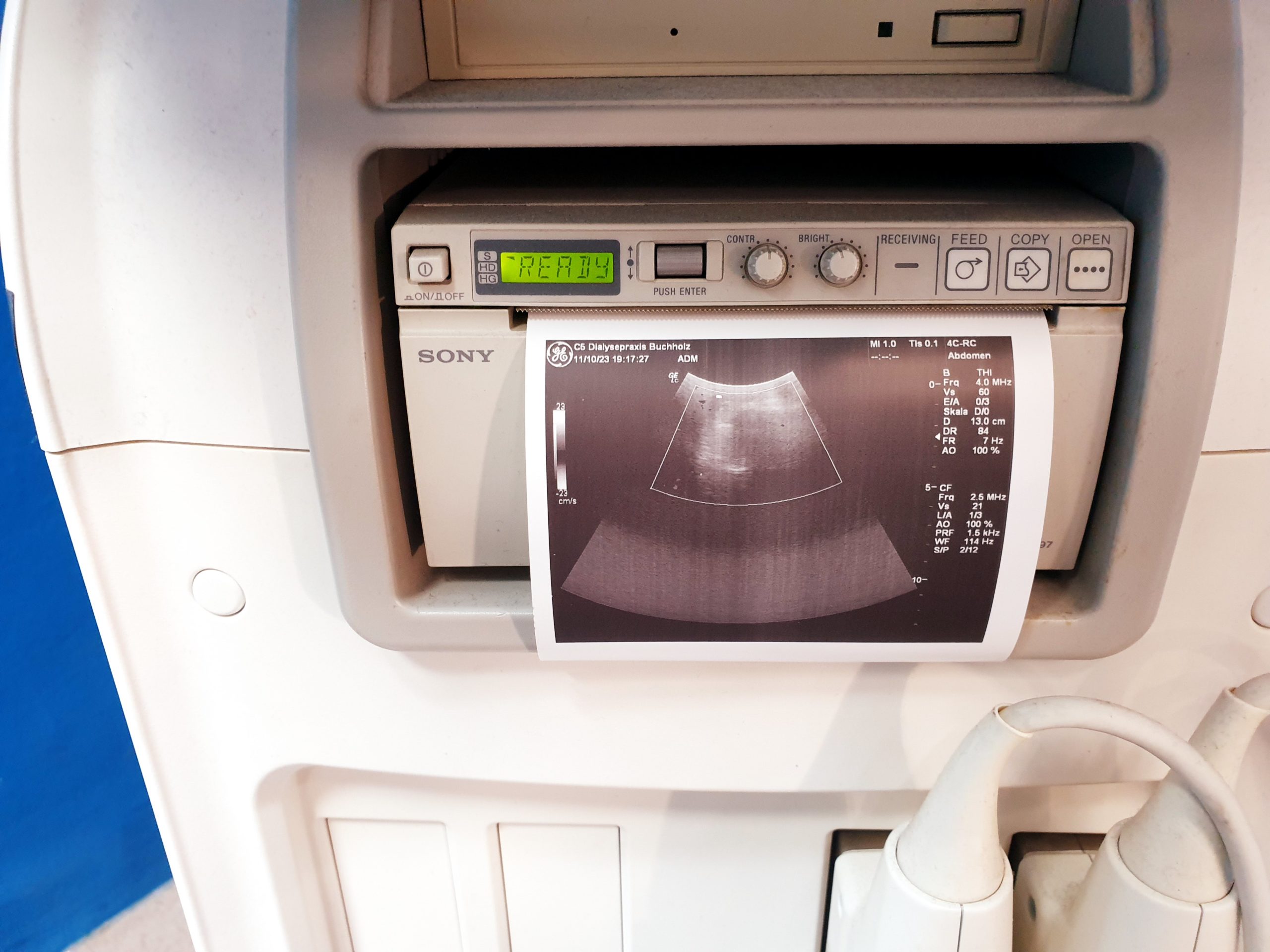 GE Logiq C5 Premium 4C-RS + 7.5L-RS Farbdoppler – Doppler thumbnail 6