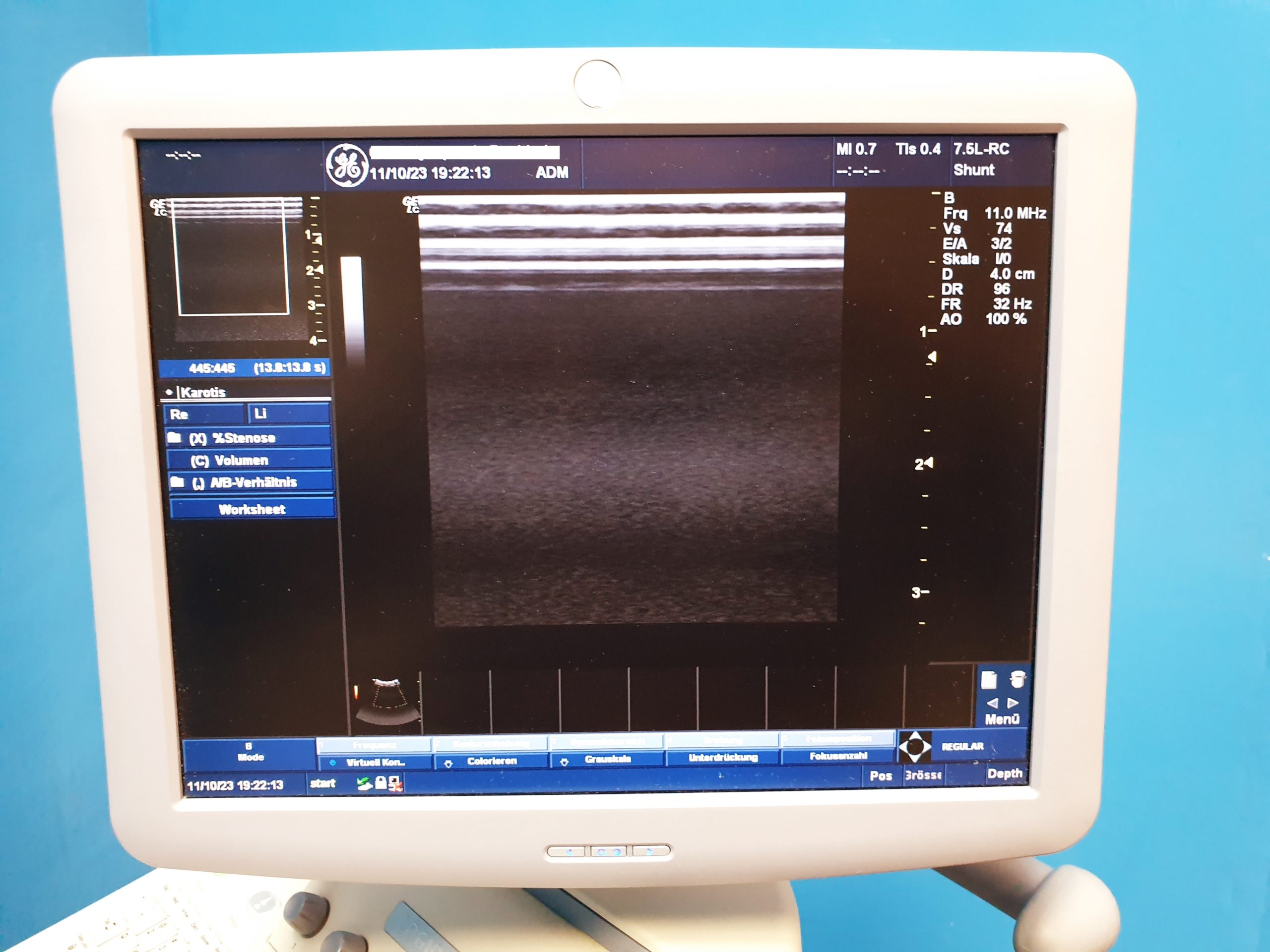 GE Logiq C5 Premium 4C-RS + 7.5L-RS Farbdoppler – Doppler thumbnail 10
