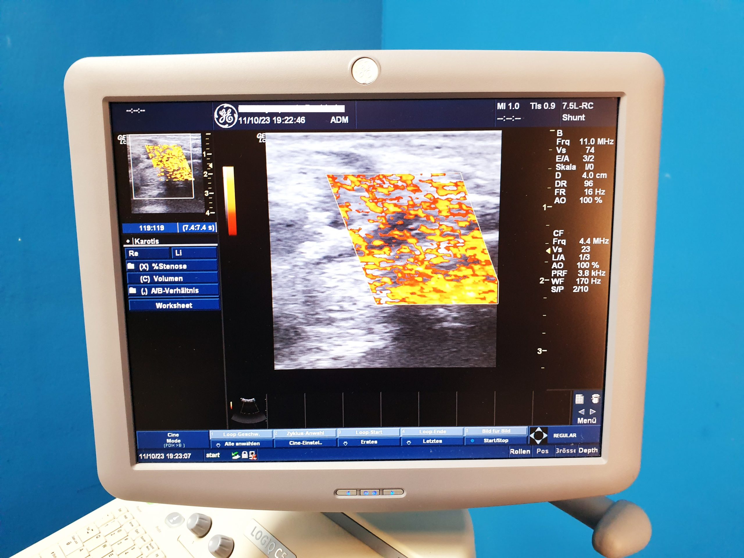GE Logiq C5 Premium 4C-RS + 7.5L-RS Farbdoppler – Doppler thumbnail 11