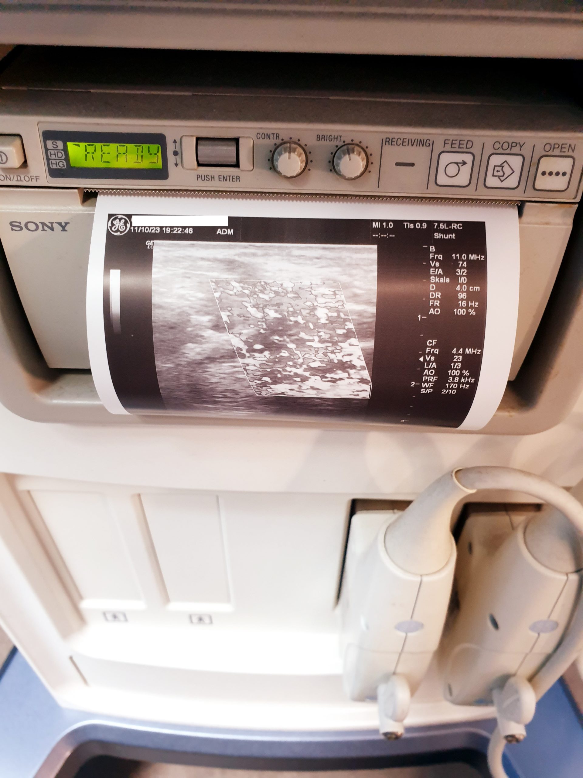 GE Logiq C5 Premium 4C-RS + 7.5L-RS Farbdoppler – Doppler thumbnail 12