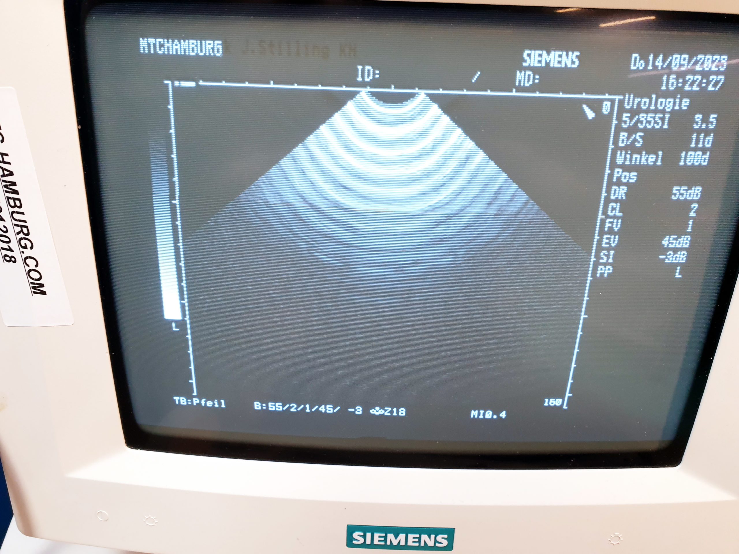 SIEMENS Sonoline Prima Ultraschallgerät + Konvex + Linear + Sektor thumbnail 10