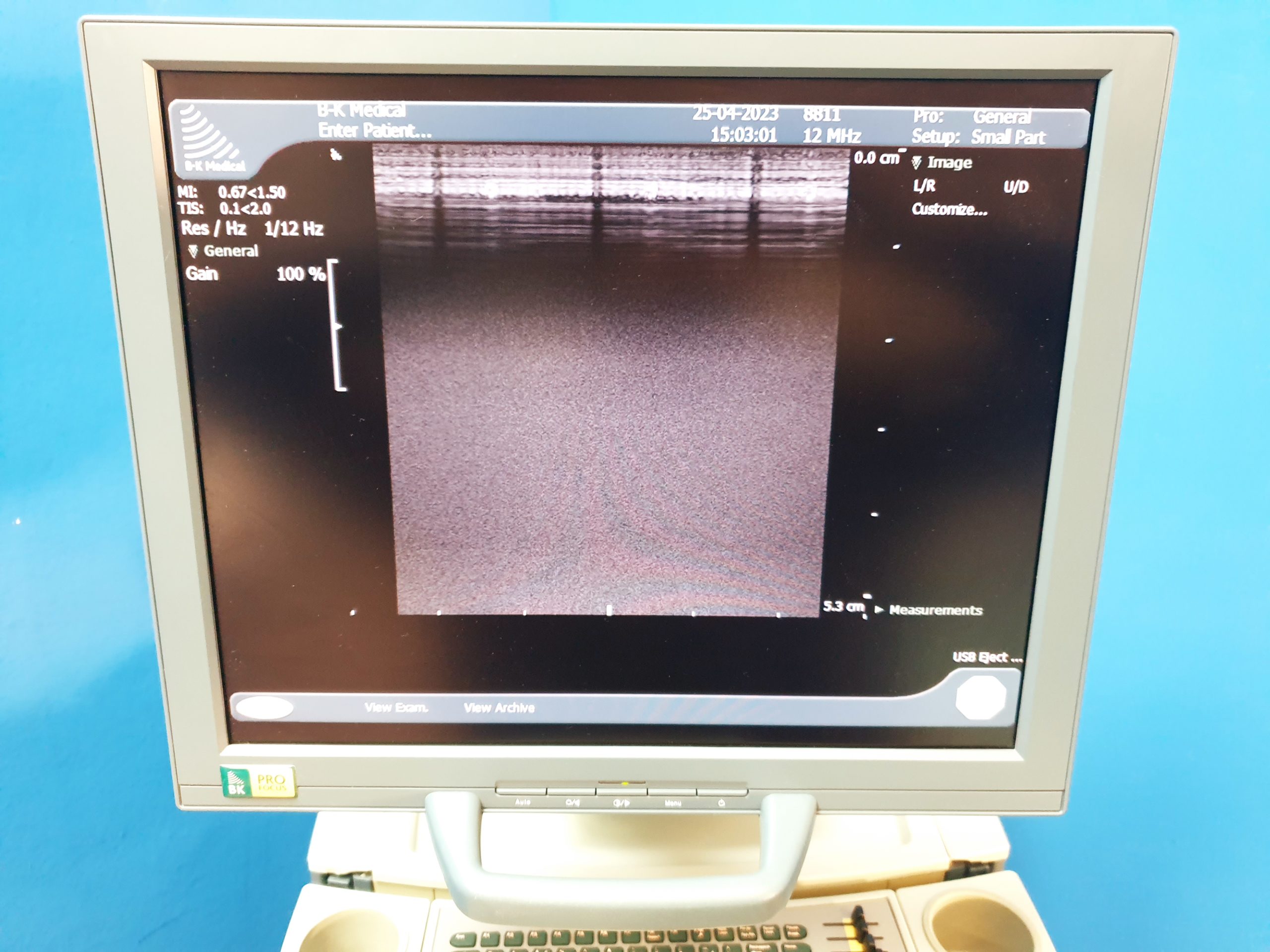 BK MEDICAL Pro Focus 2202 + 8811 Linear Sonde thumbnail 3