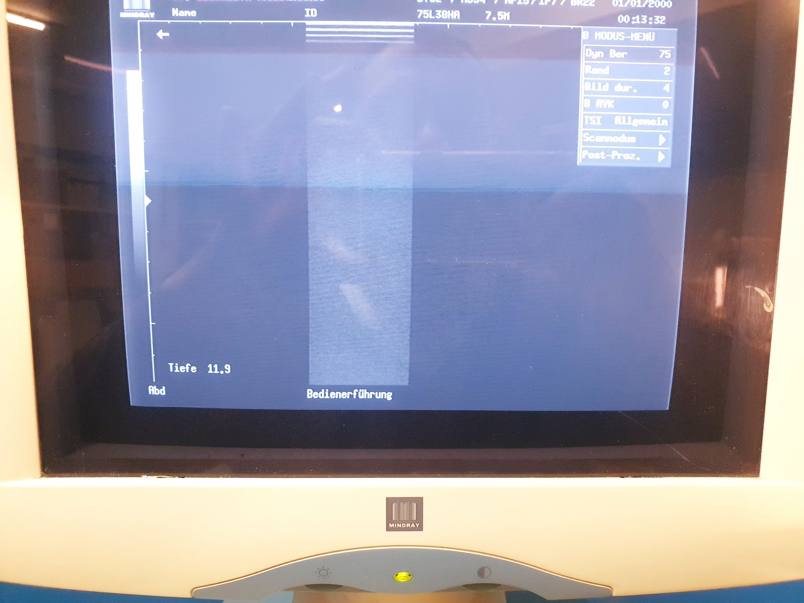 Mindray DP-9900 Plus DP9900PLUS MIT 7.5MHz Probe – Linear Probe thumbnail 3