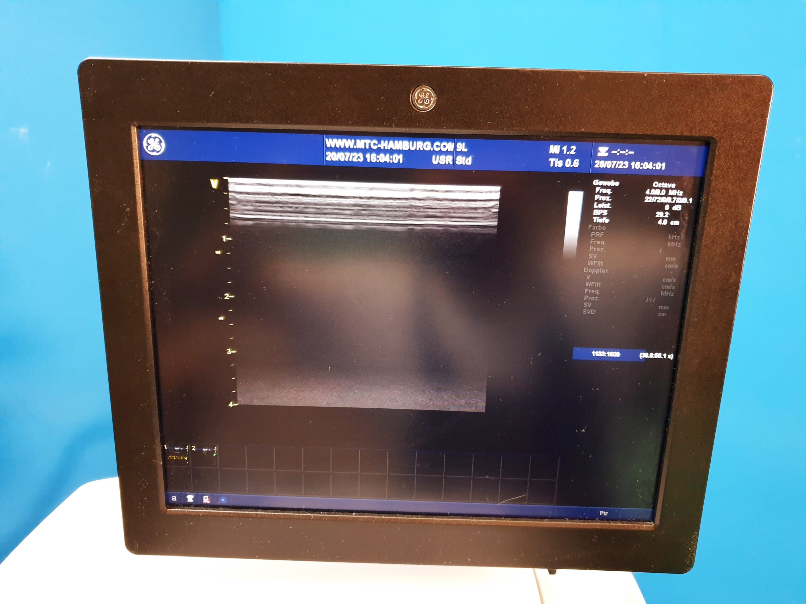 GE Vivid E9 Version 112 + M5S +9L DOM 2012 Kardiomaschine thumbnail 6