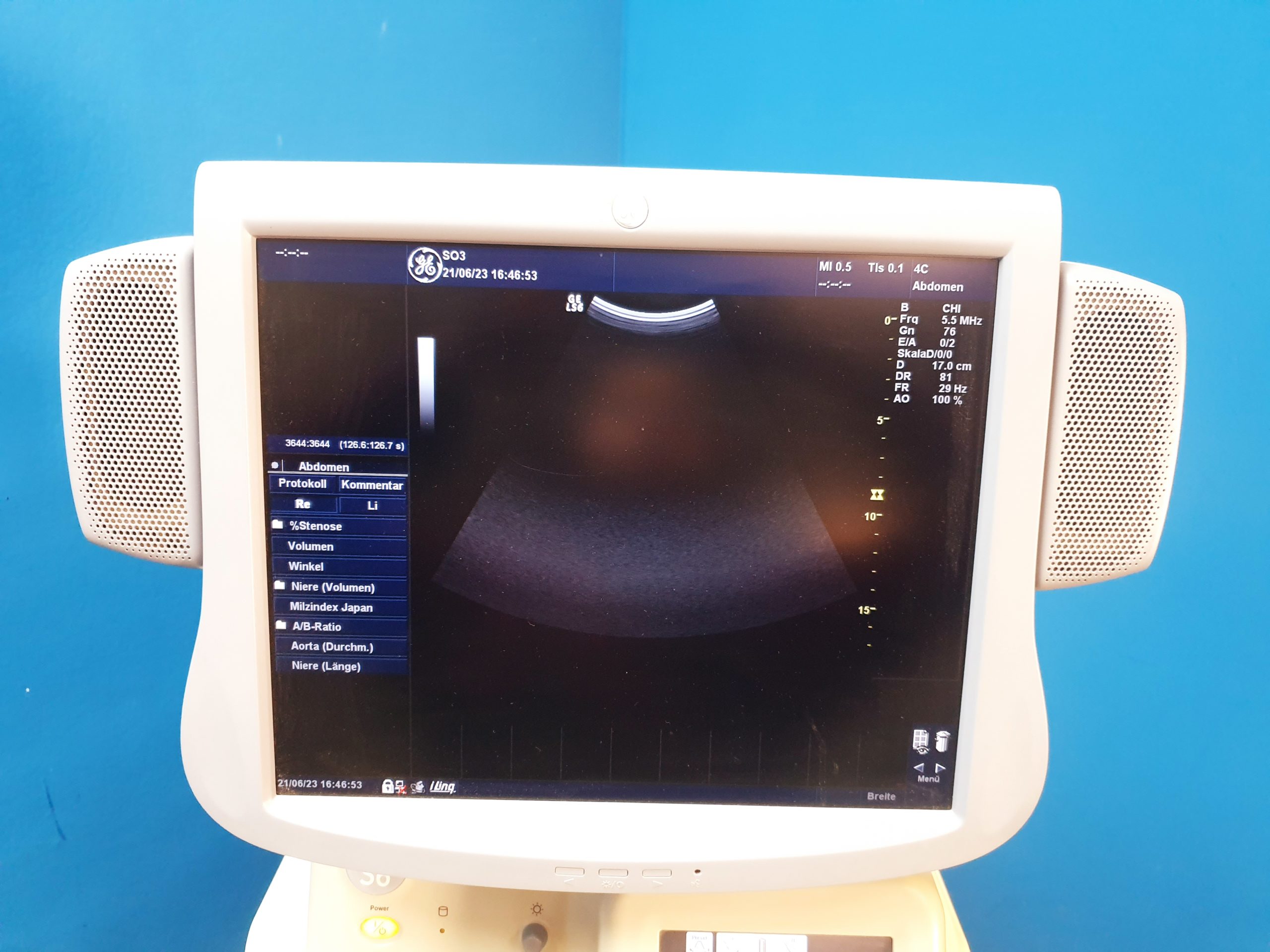 GE LOGIQ S6 S 6 mit Konvex 4C + 7L Linear Sonde Doppler – Farbdoppler thumbnail 3