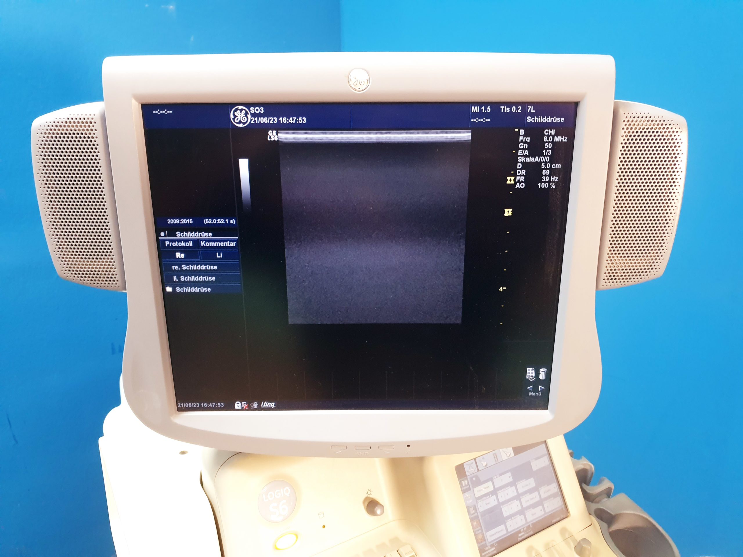GE LOGIQ S6 S 6 mit Konvex 4C + 7L Linear Sonde Doppler – Farbdoppler thumbnail 5