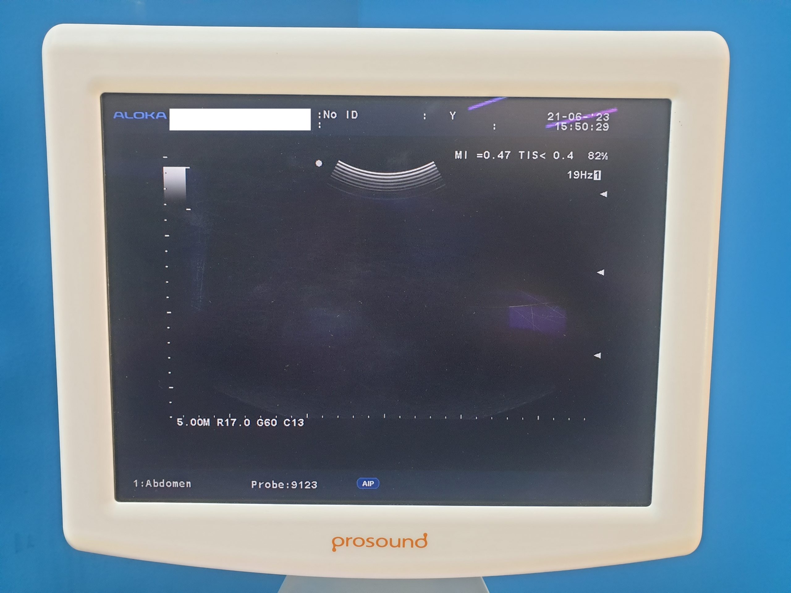 Aloka Prosound Alpha 6 + UST-568 + UST5123 Konvex und Linear thumbnail 3