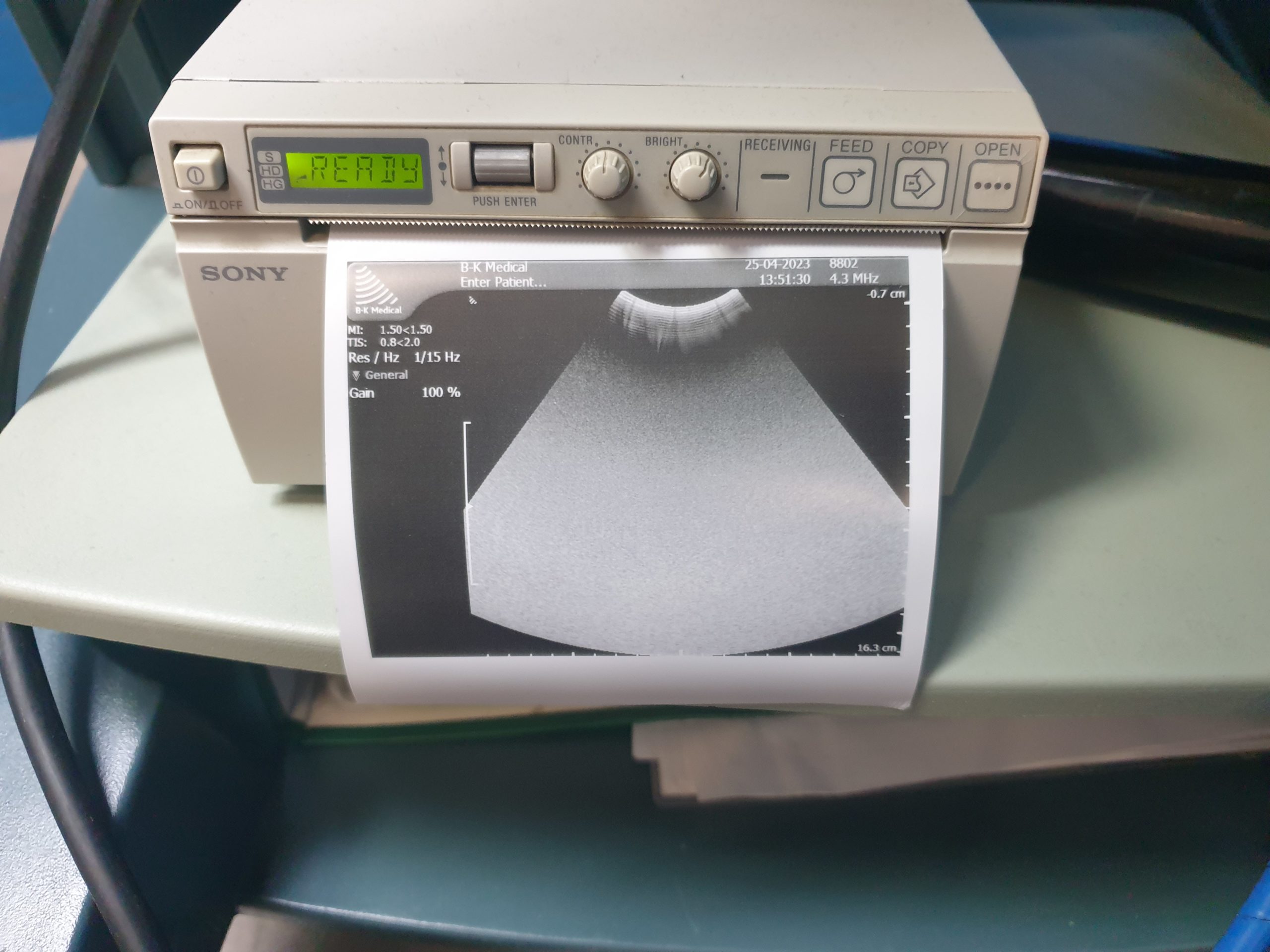 BK B K Medical 8802 // 4.3 MHz. – 6.0 MHz Kompatibel mit Medical Hawk 2102; BK Medical Flex Focus 400; BK Medical Falcon 2101 ultrasound systems. thumbnail 4