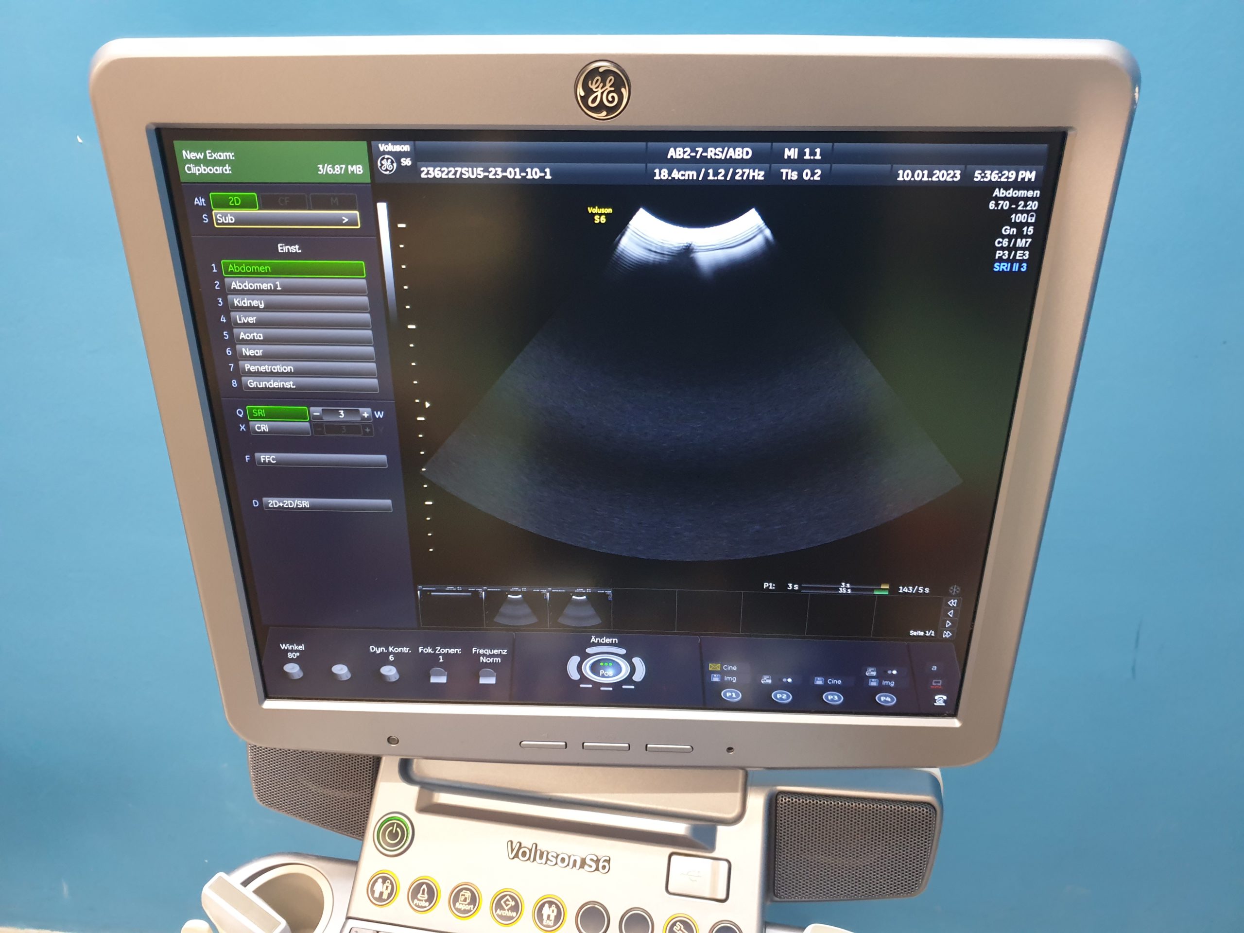 GE AB2-7-RS Curved Array Probe thumbnail 2