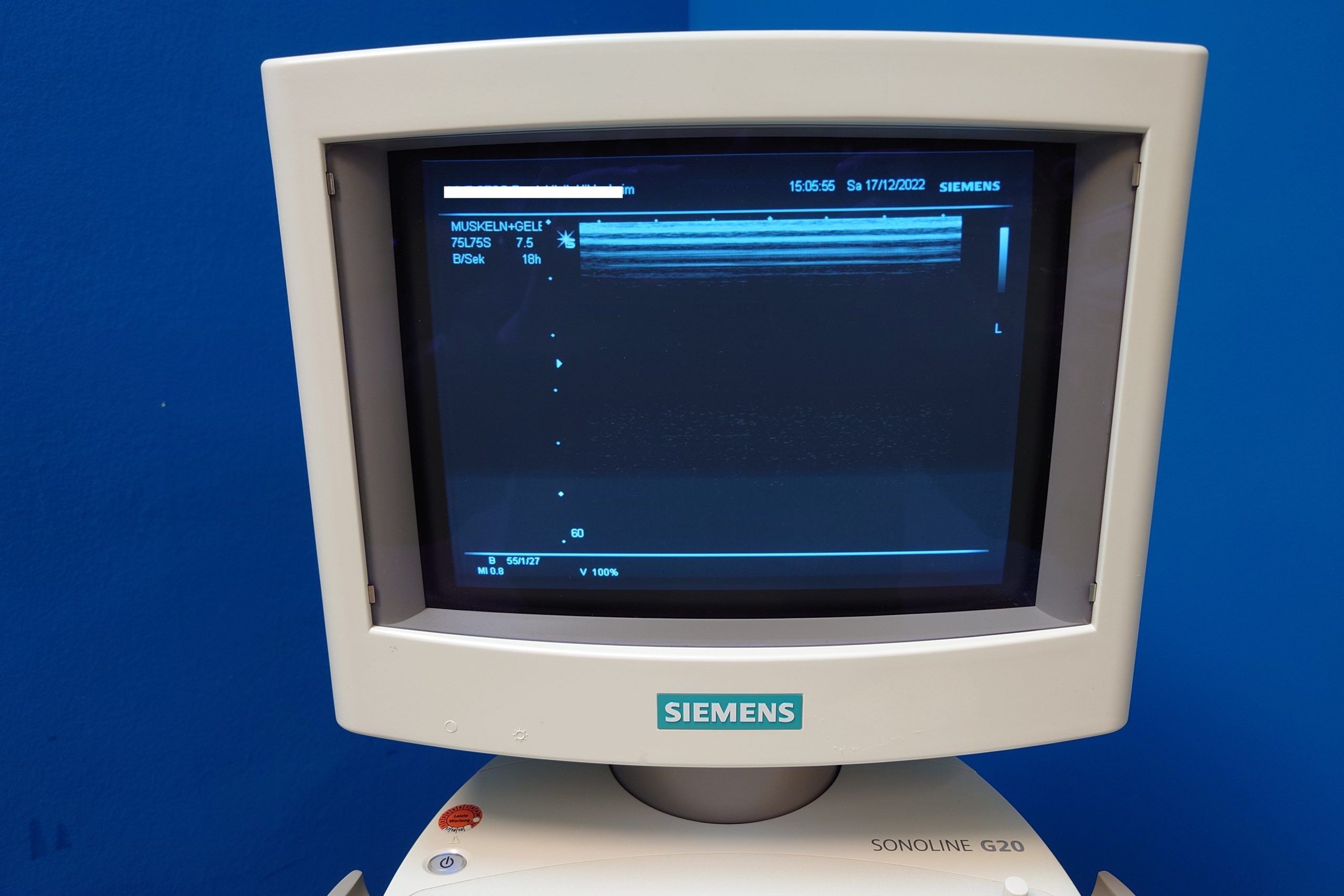 Siemens G20 G 20 mit 75L75S 7.5 Linear und Printer thumbnail 2