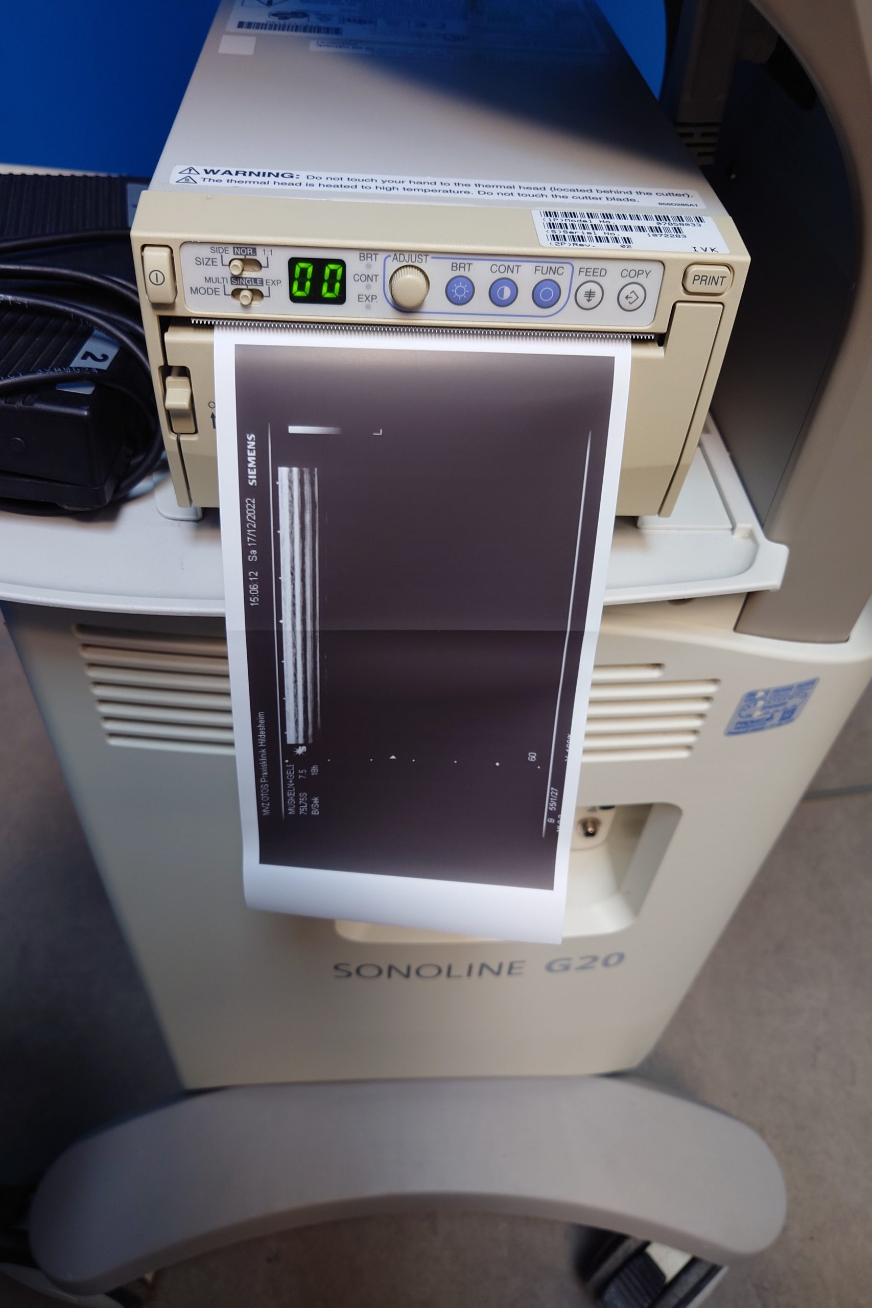 Siemens G20 G 20 mit 75L75S 7.5 Linear und Printer thumbnail 4
