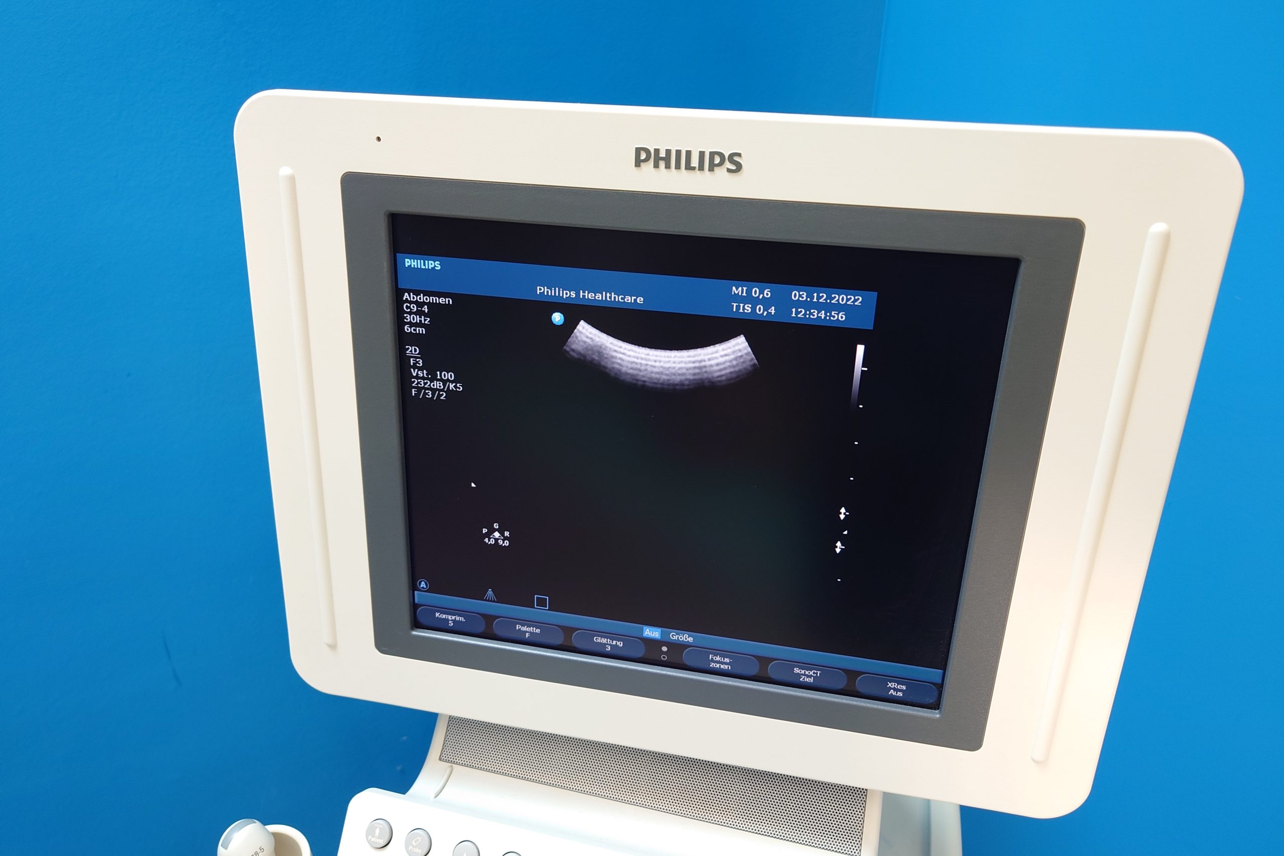 Philips HD11XE – 11 XE mit C6-3 + C9-4 + L12-5 + C5-2 + C8-5 thumbnail 9
