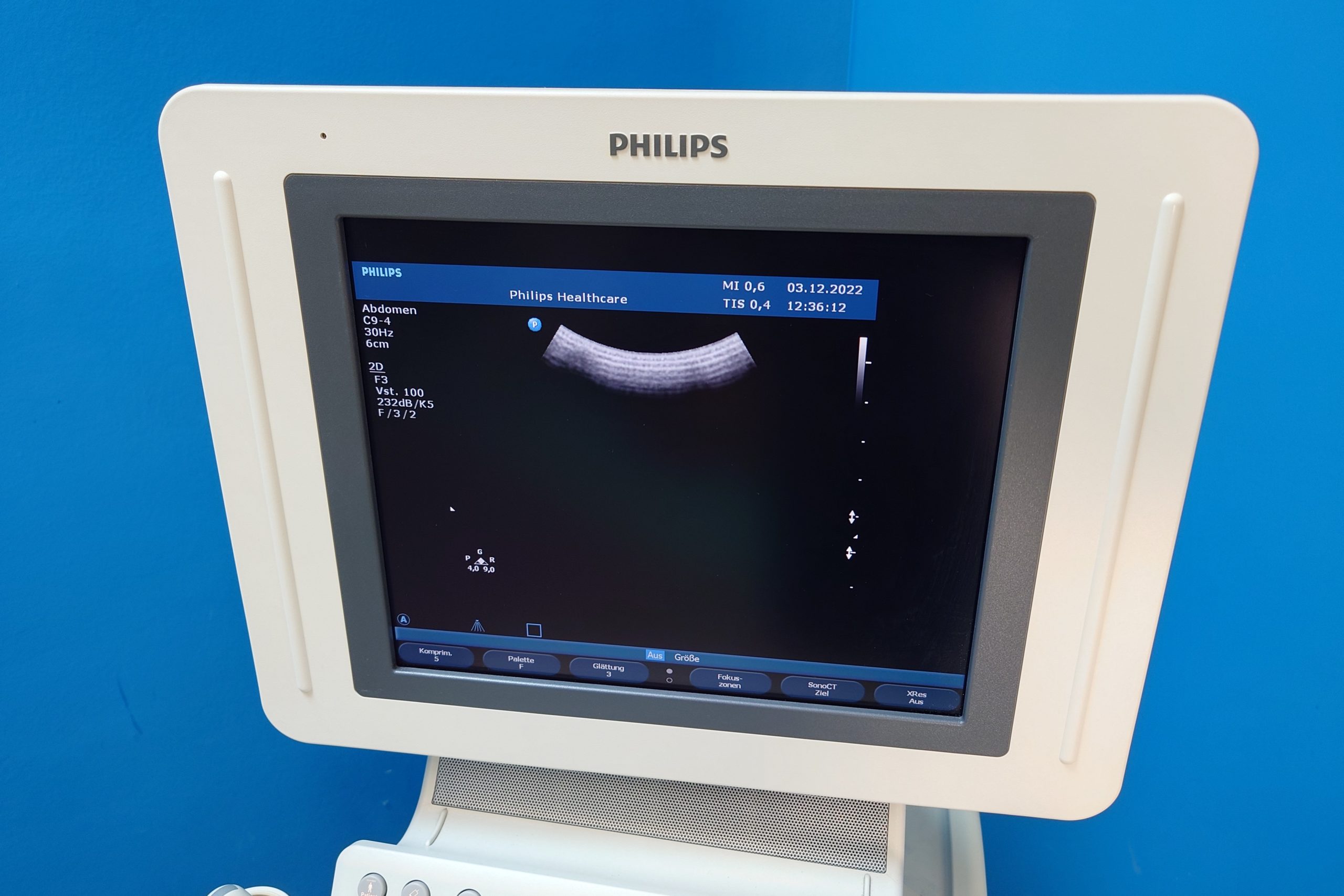 Philips HD11XE – 11 XE mit C6-3 + C9-4 + L12-5 + C5-2 + C8-5 thumbnail 11