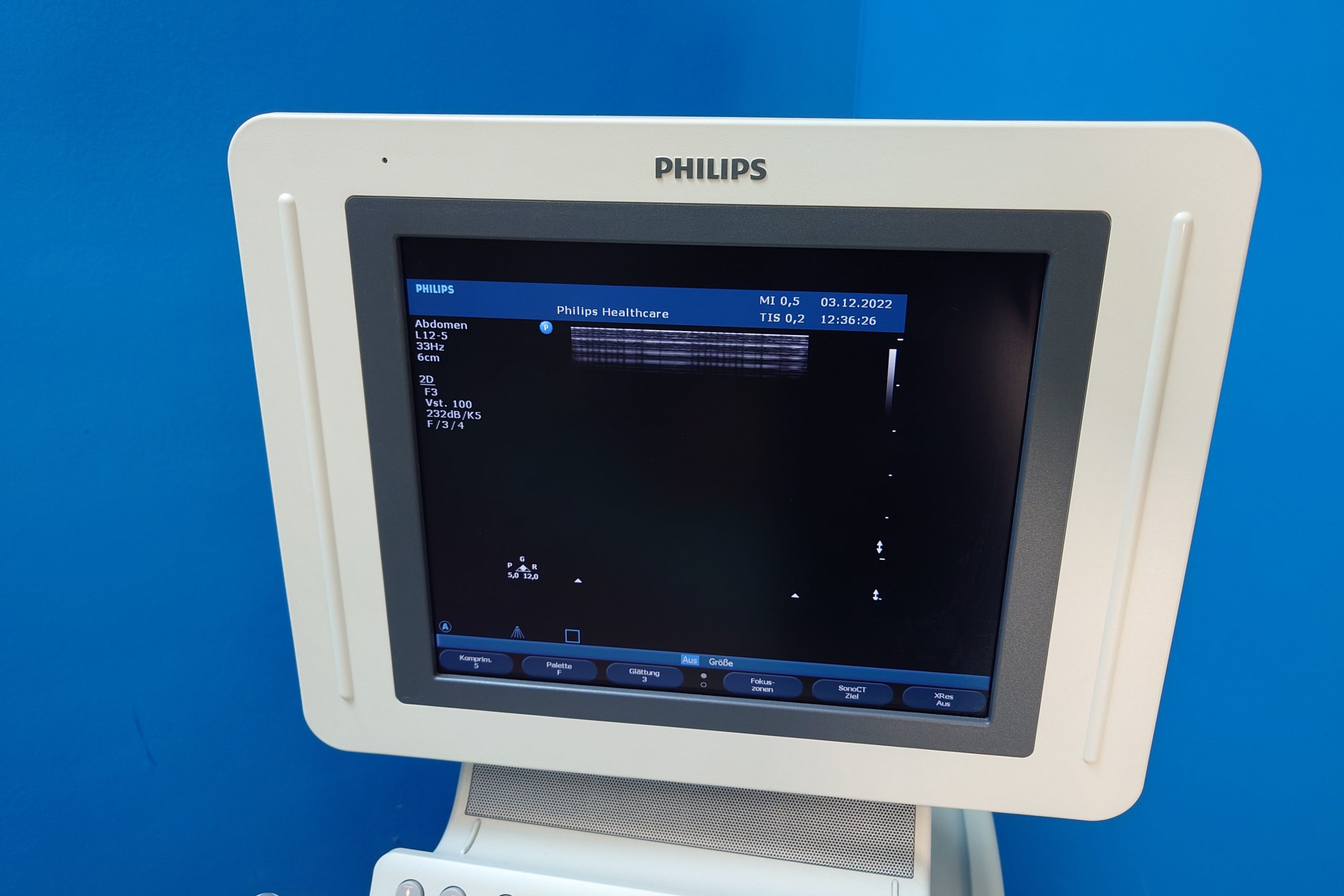 Philips HD11XE – 11 XE mit C6-3 + C9-4 + L12-5 + C5-2 + C8-5 thumbnail 13