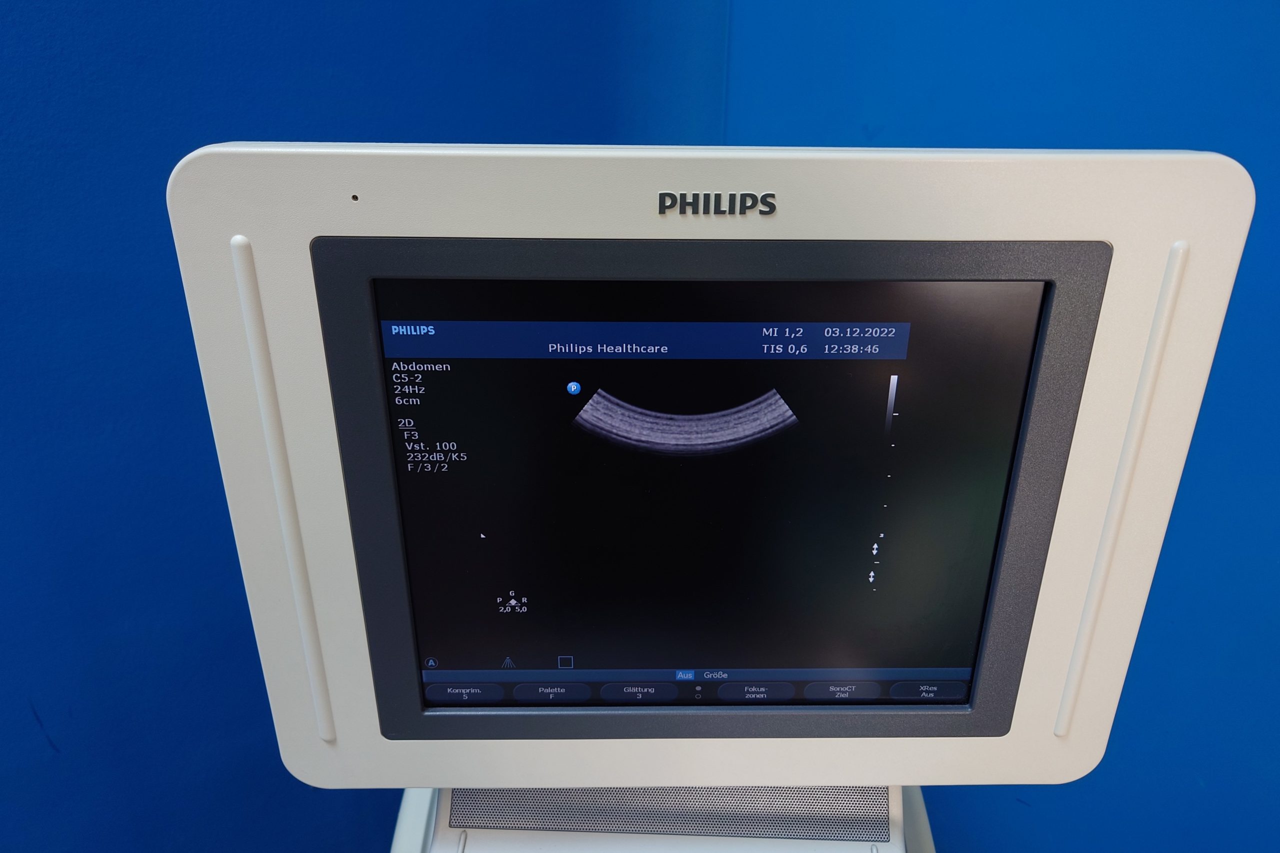 Philips HD11XE – 11 XE mit C6-3 + C9-4 + L12-5 + C5-2 + C8-5 thumbnail 15