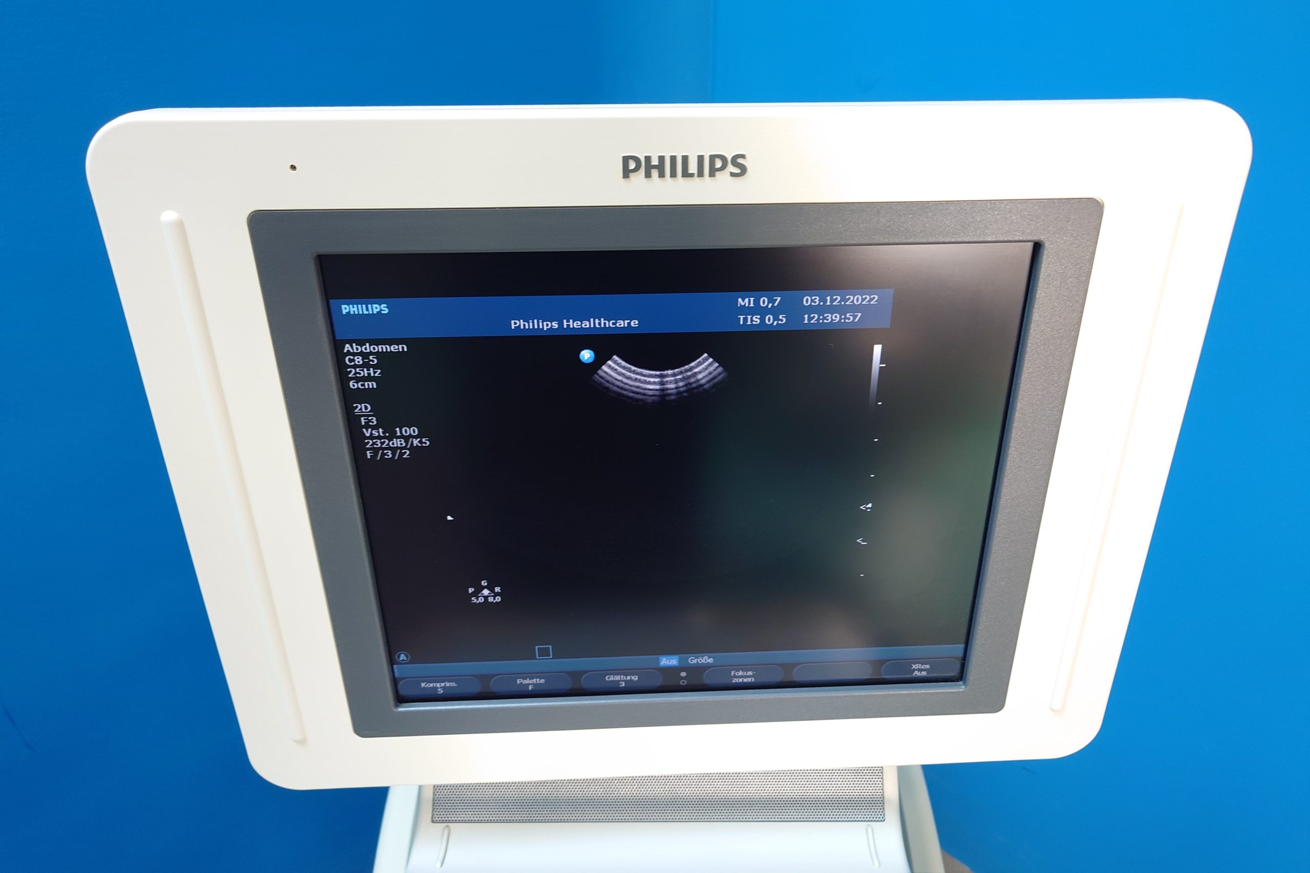 Philips HD11XE – 11 XE mit C6-3 + C9-4 + L12-5 + C5-2 + C8-5 thumbnail 17
