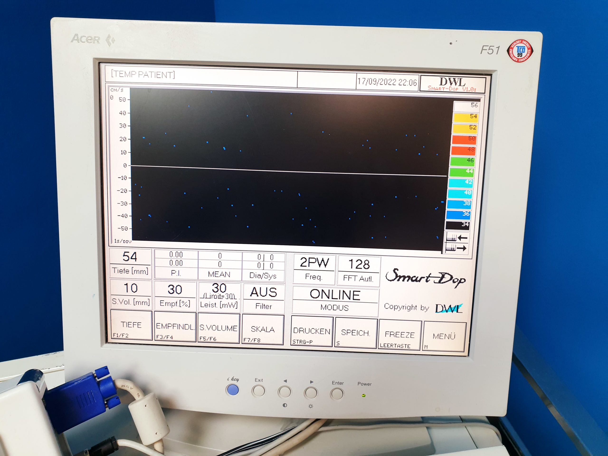DWL SMART DOP LDP4 + ZUBEHÖR Fetal-Doppler thumbnail 4