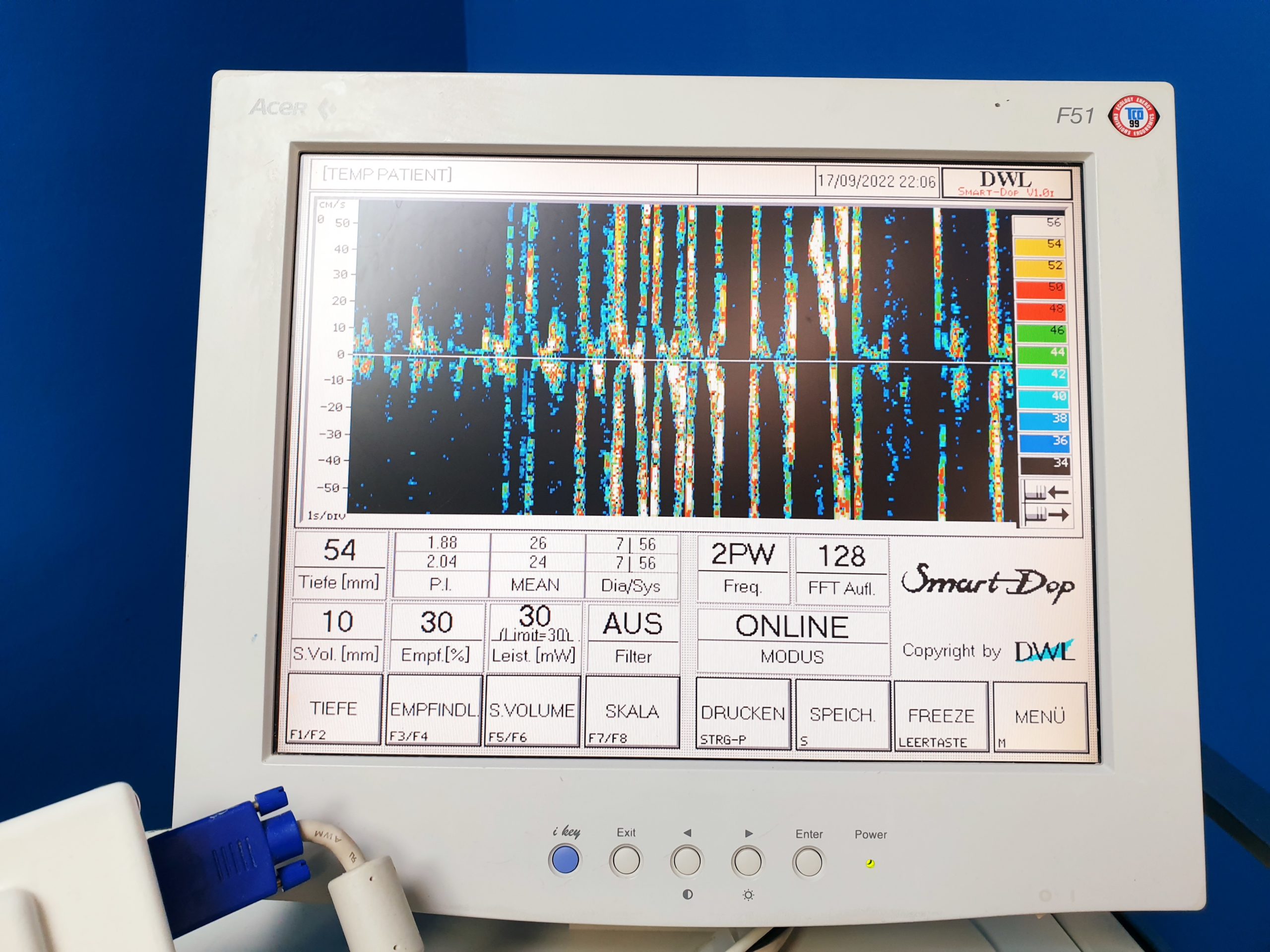DWL SMART DOP LDP4 + ZUBEHÖR Fetal-Doppler thumbnail 5