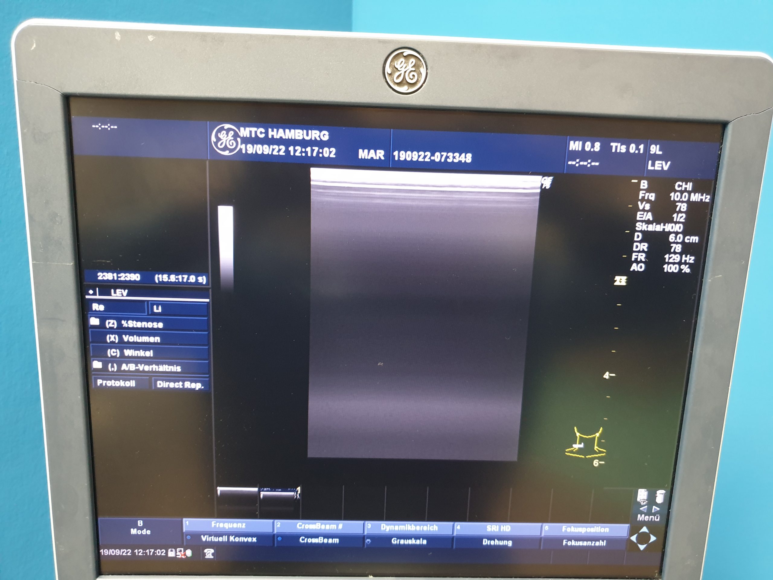 GE Logiq P6 BT11 View mit 3Sp Echosonde und 9L Linear Sonde und Konvex 4C DOM 2009 thumbnail 5