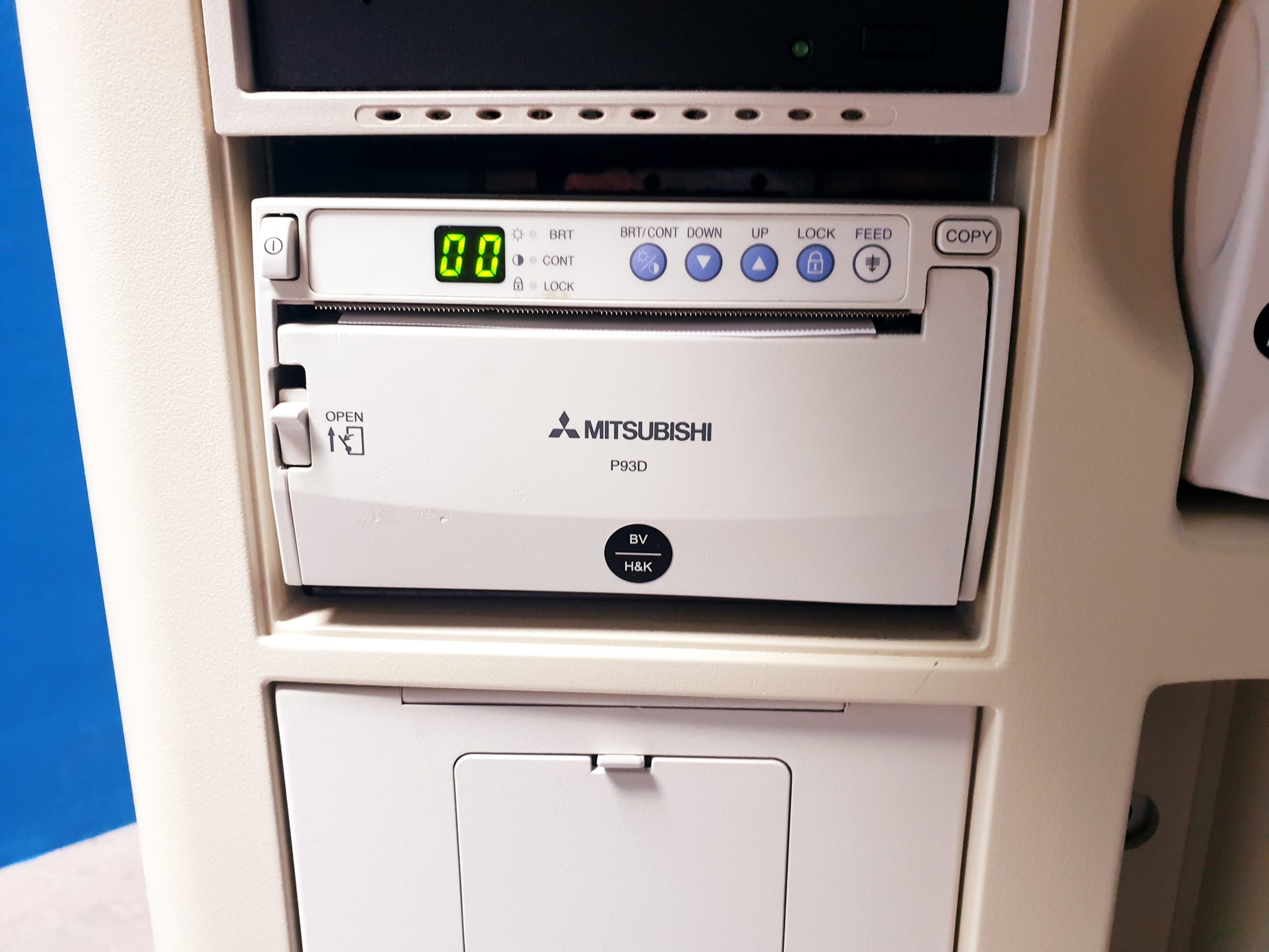 Toshiba Aplio XG SSA-790A mit 6C1 Konvex und 11L5 Linear thumbnail 6