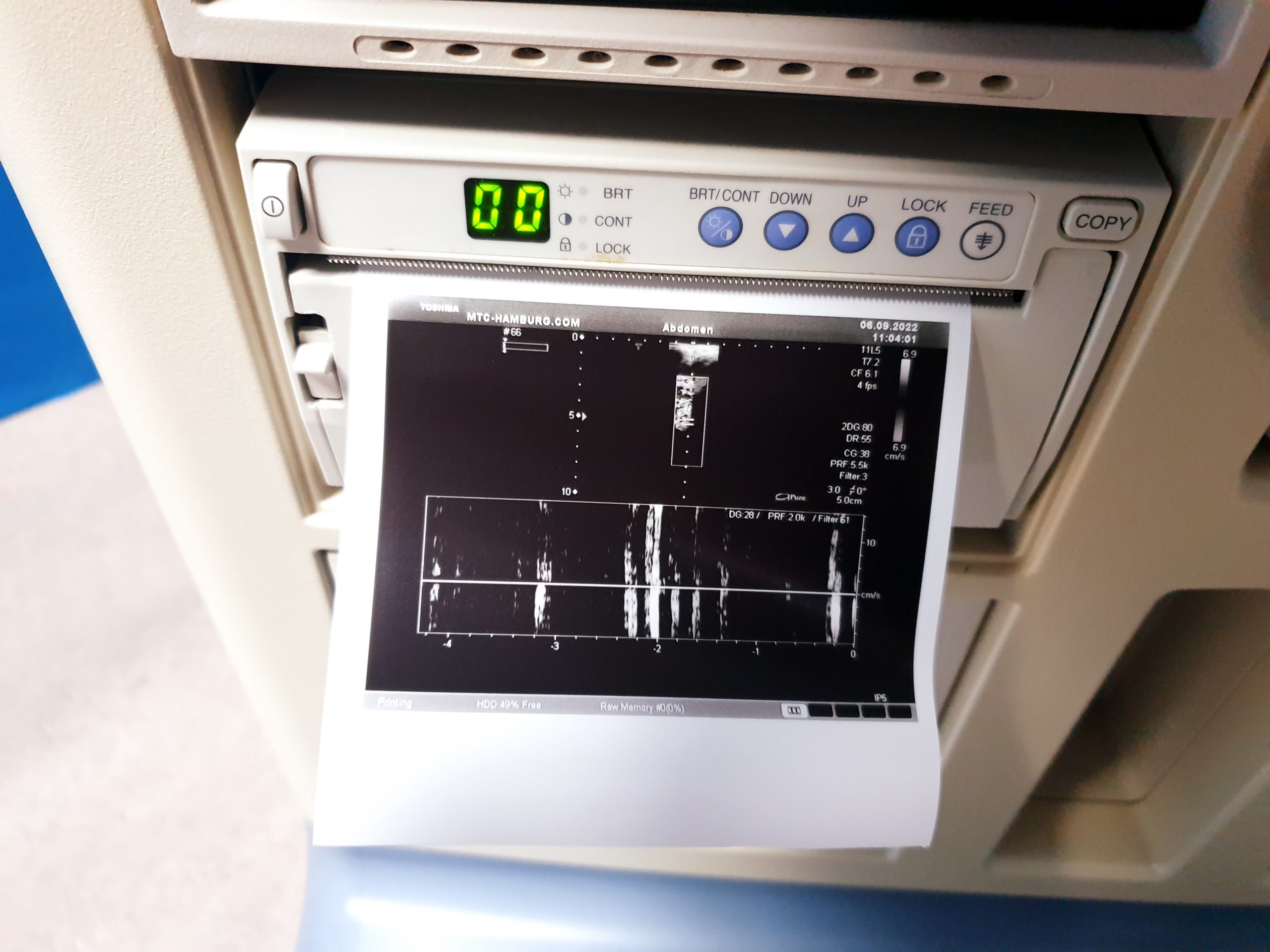 Toshiba Aplio XG SSA-790A mit 6C1 Konvex und 11L5 Linear thumbnail 7