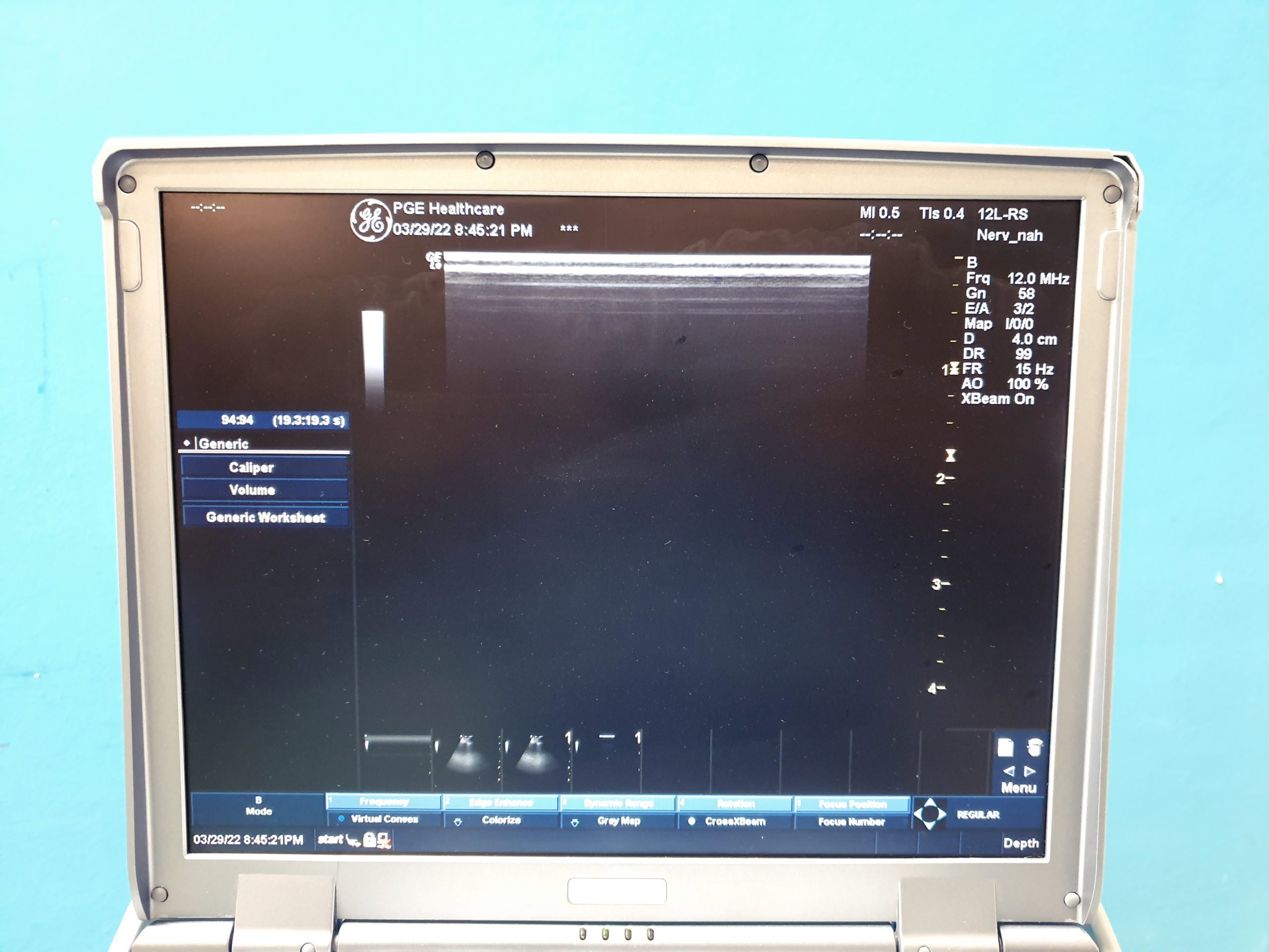 GE Logiq E 12L-RS + 4C-RS + 3S-RS + UP-D897 DOM 2009 thumbnail 4