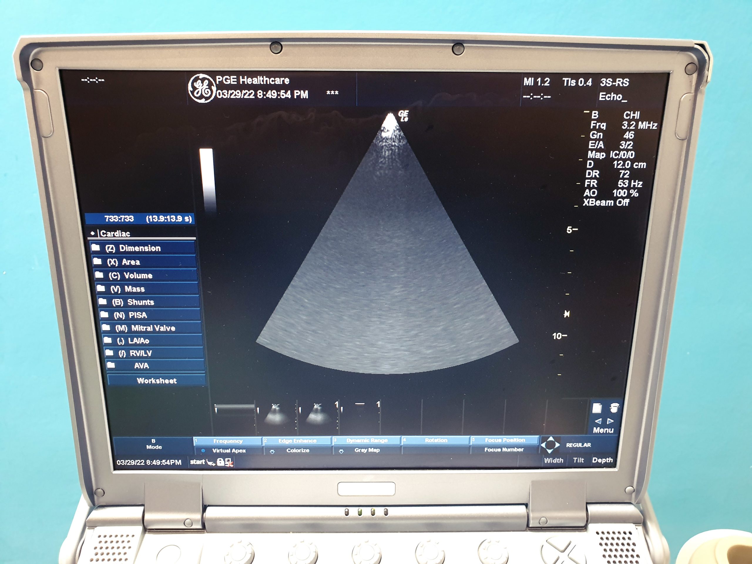 GE Logiq E 12L-RS + 4C-RS + 3S-RS + UP-D897 DOM 2009 thumbnail 8