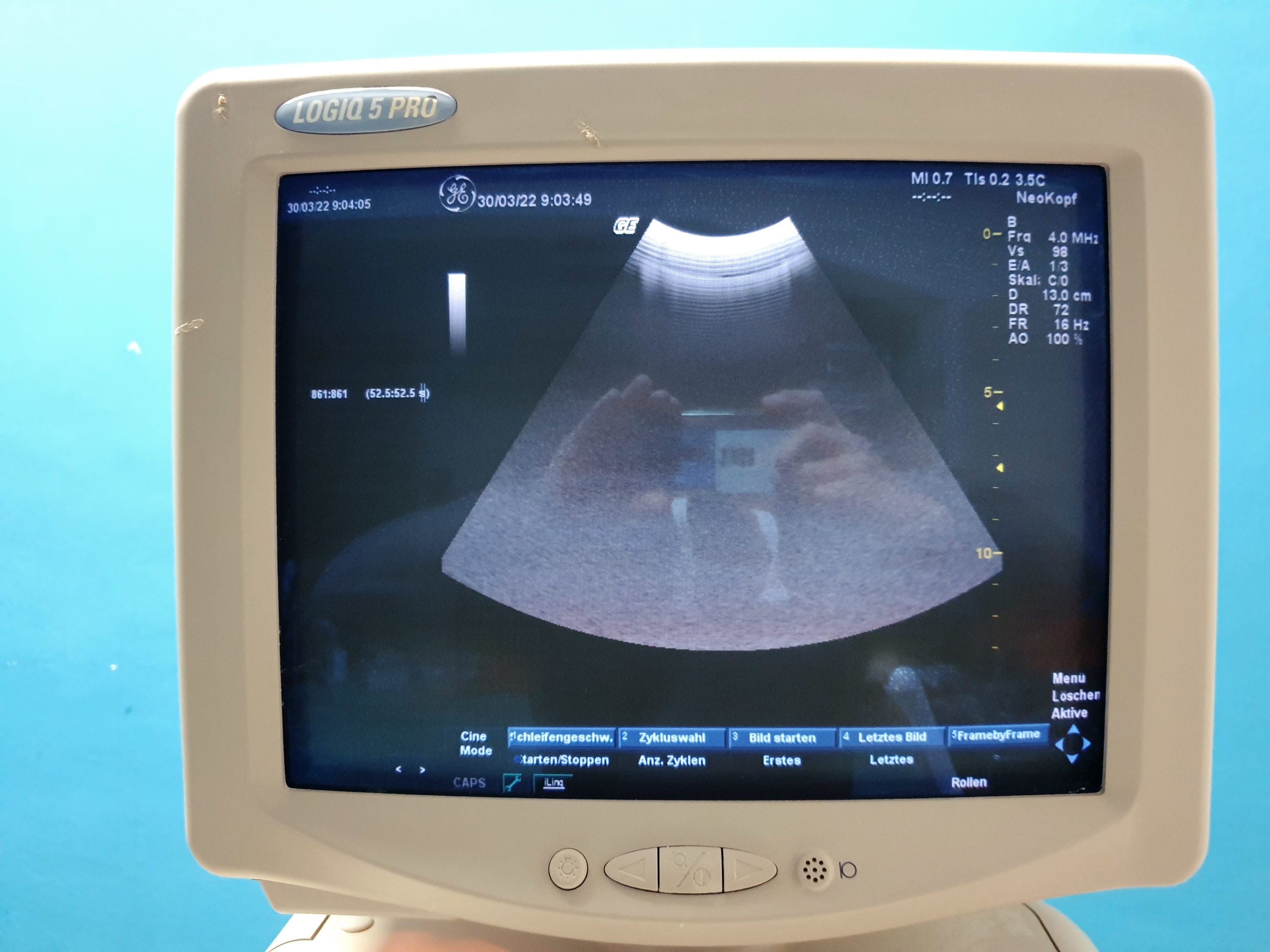 GE Logiq 5 Pro Farbdoppler Ultraschallgerät mit konvex, Linear, Endovaginal und Kardiosonde thumbnail 4