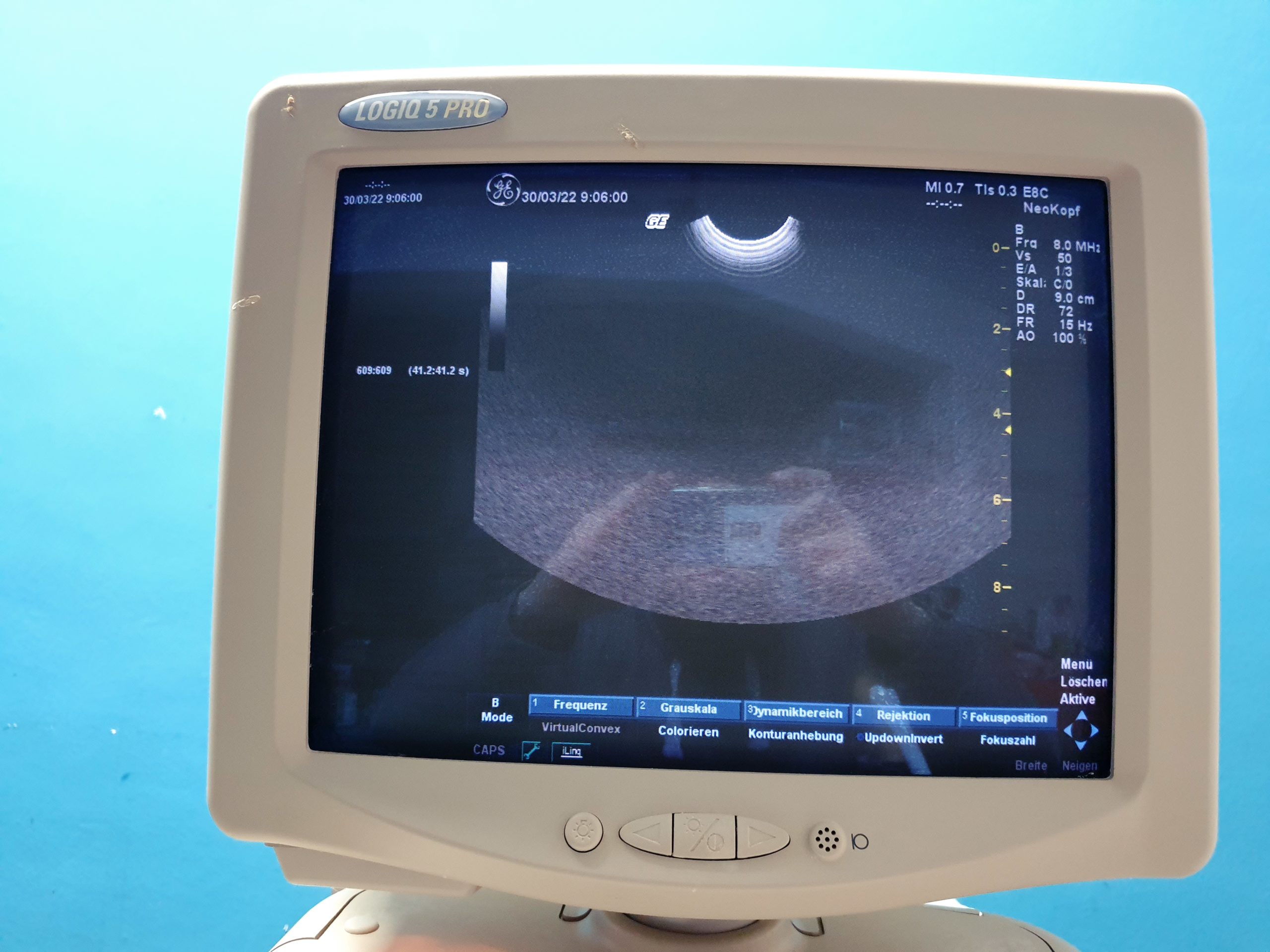GE Logiq 5 Pro Farbdoppler Ultraschallgerät mit konvex, Linear, Endovaginal und Kardiosonde thumbnail 7