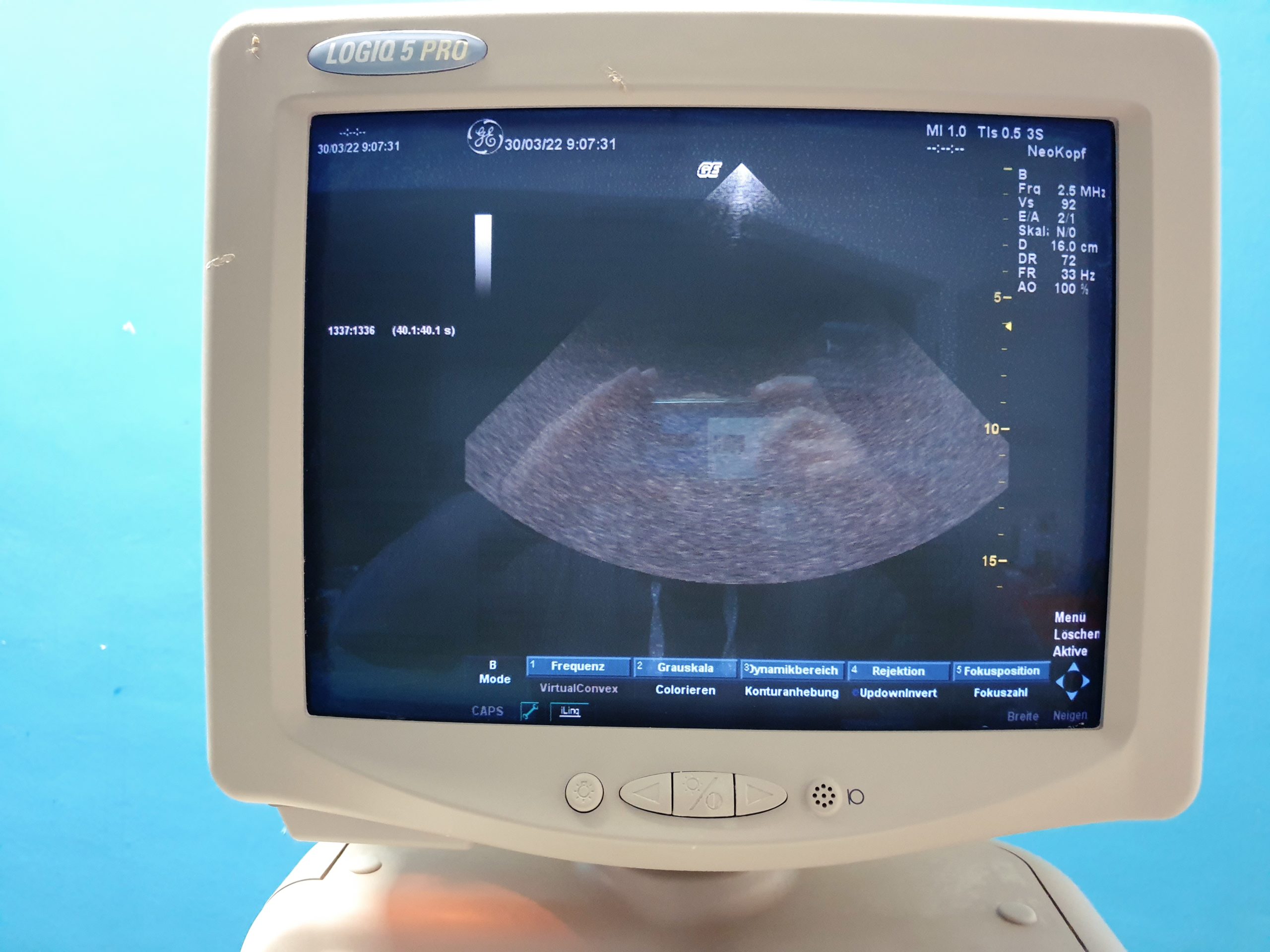 GE Logiq 5 Pro Farbdoppler Ultraschallgerät mit konvex, Linear, Endovaginal und Kardiosonde thumbnail 10