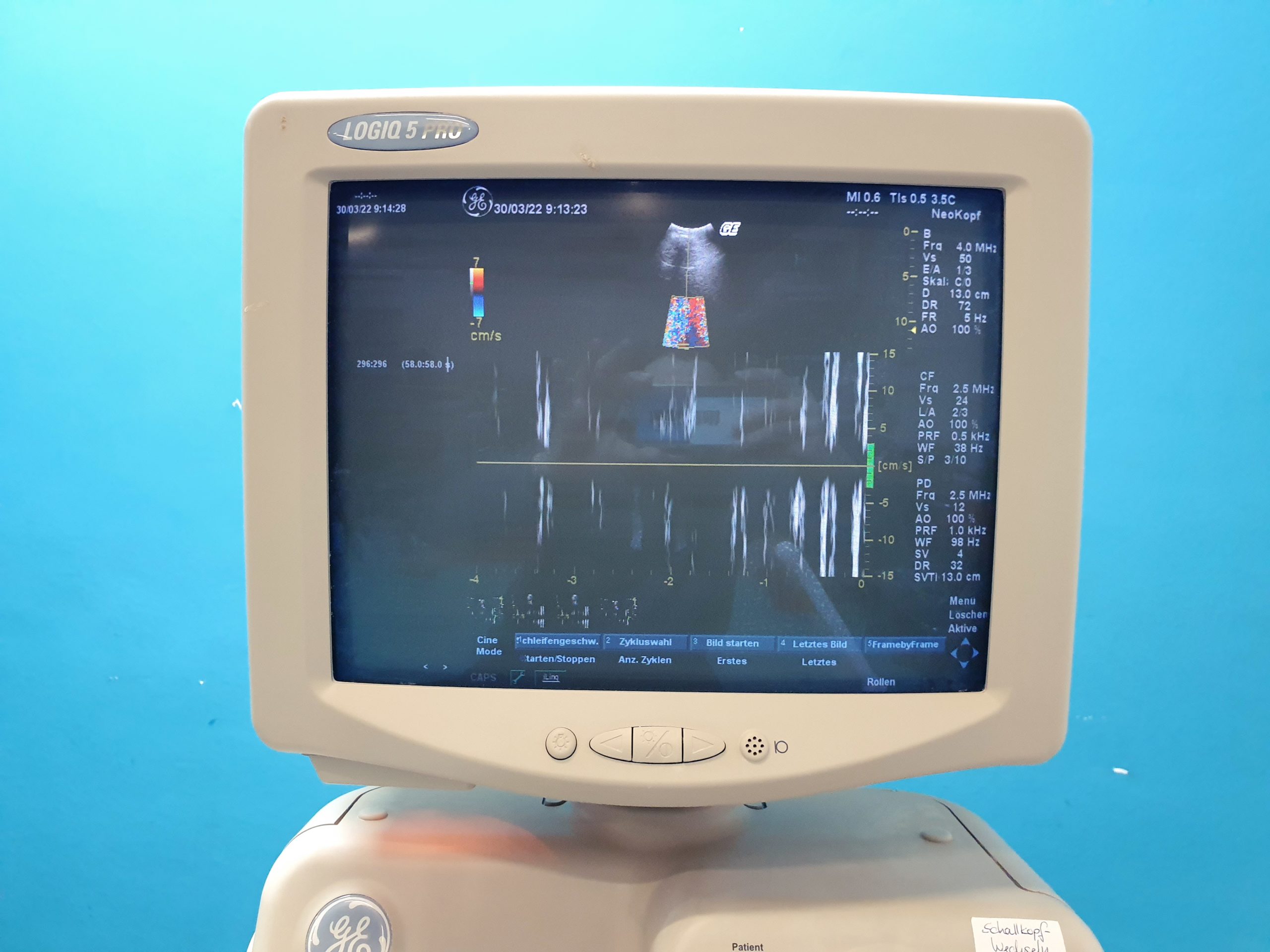 GE Logiq 5 Pro Farbdoppler Ultraschallgerät mit konvex, Linear, Endovaginal und Kardiosonde thumbnail 14