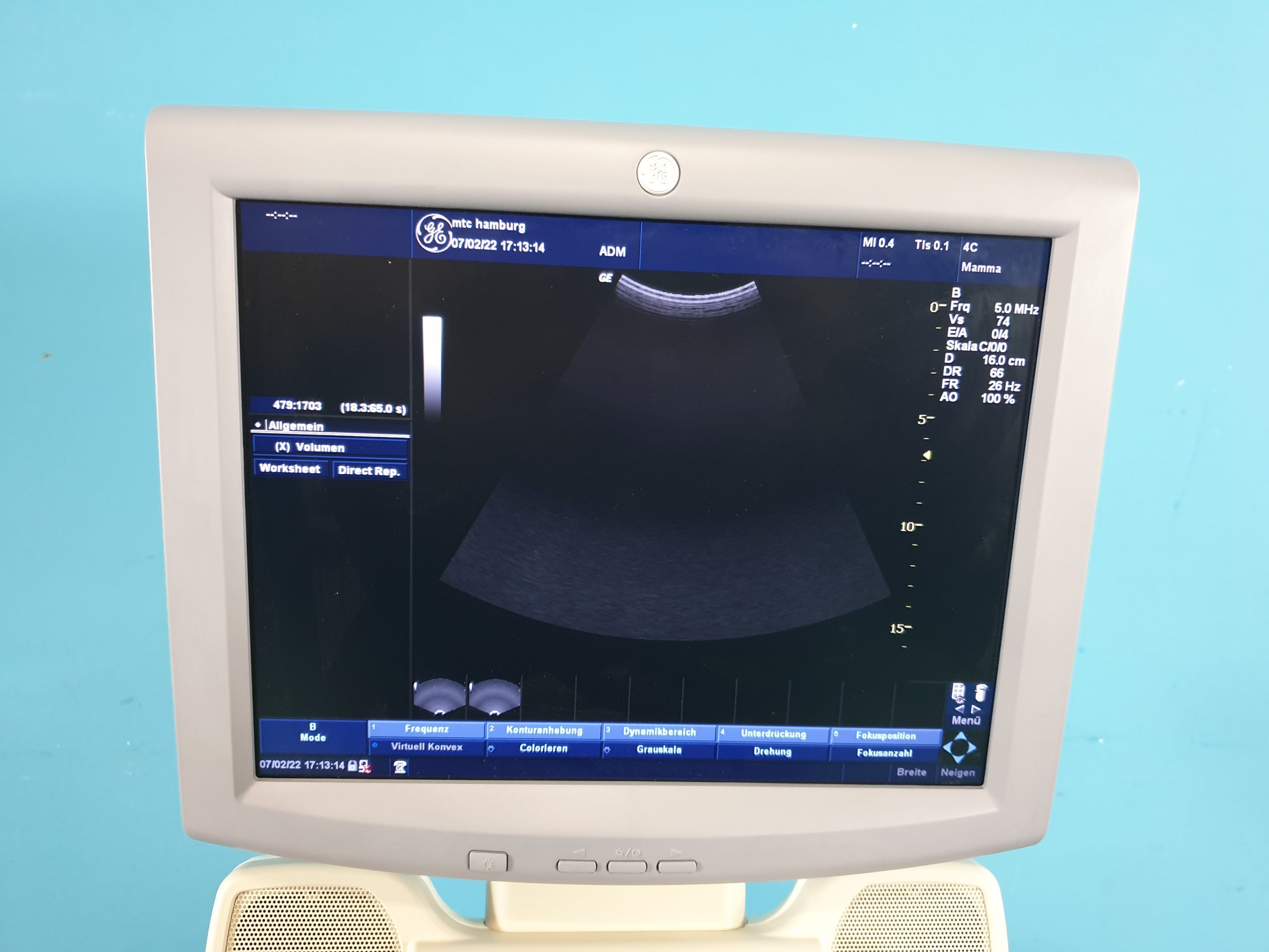 GE Logiq P5 Farbdoppler mit 4C Konvex und 12L Linear thumbnail 7