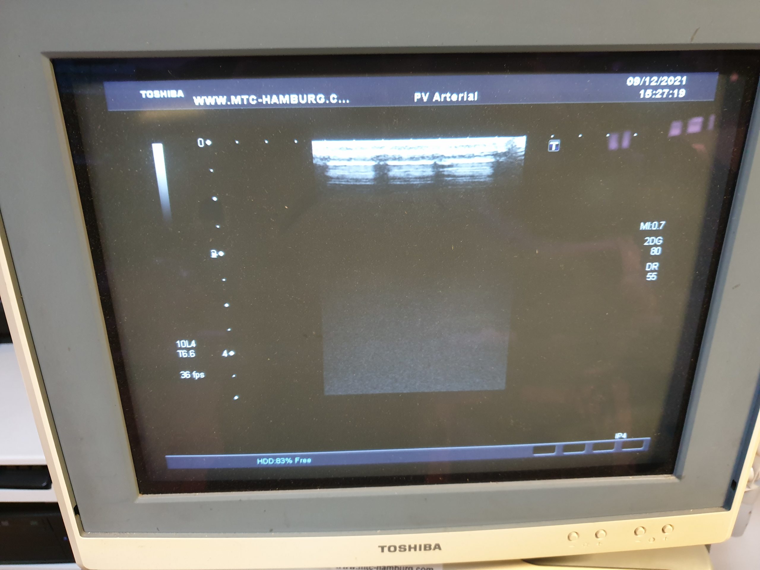 Toshiba PLT-604AT 9.2-4Mhz Linear thumbnail 5