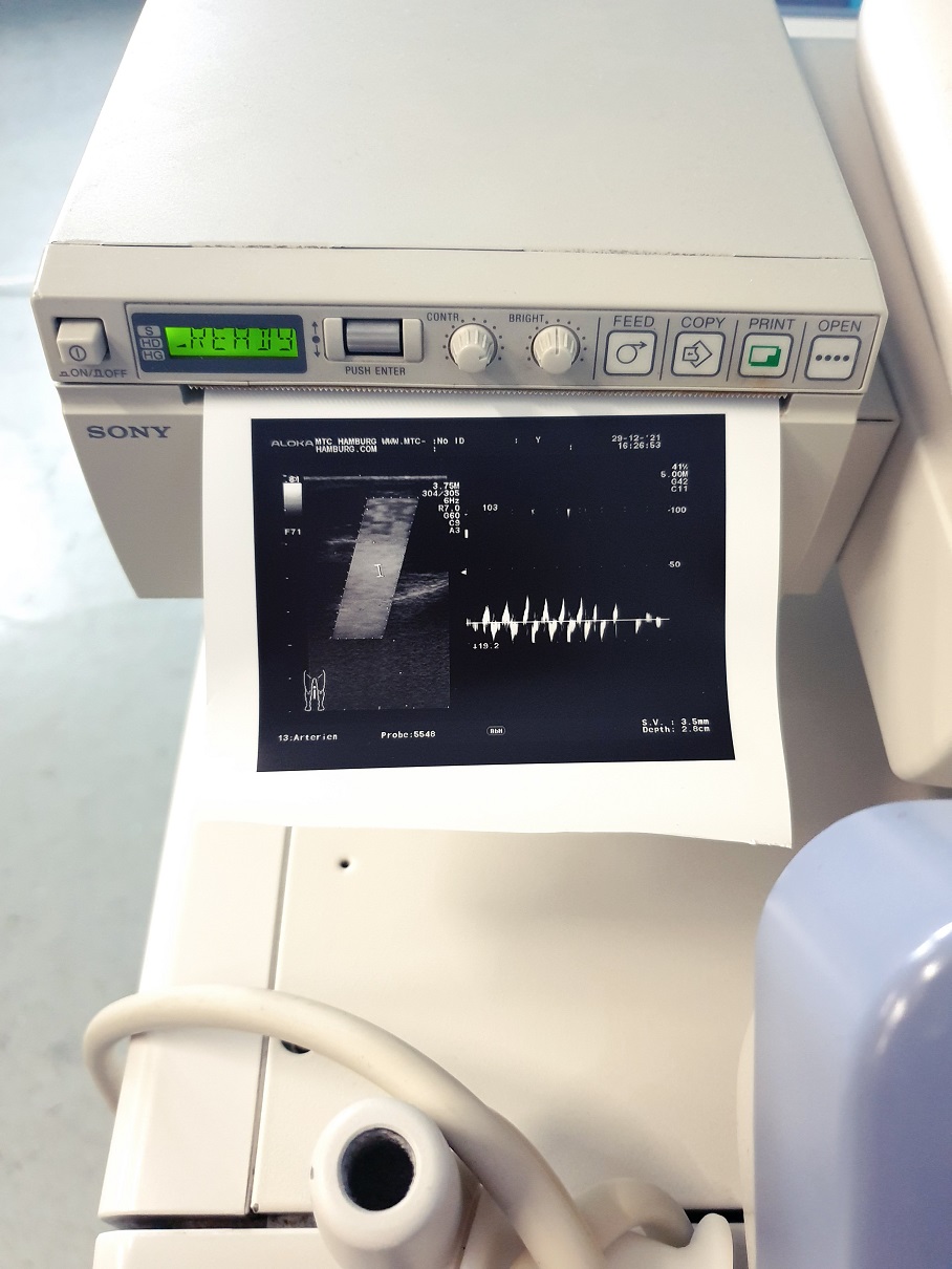 Aloka Prosound Alfa 10 Farbdoppler mit Konvex, Linear und Printer , UST-5548 // UST-9130 thumbnail 7