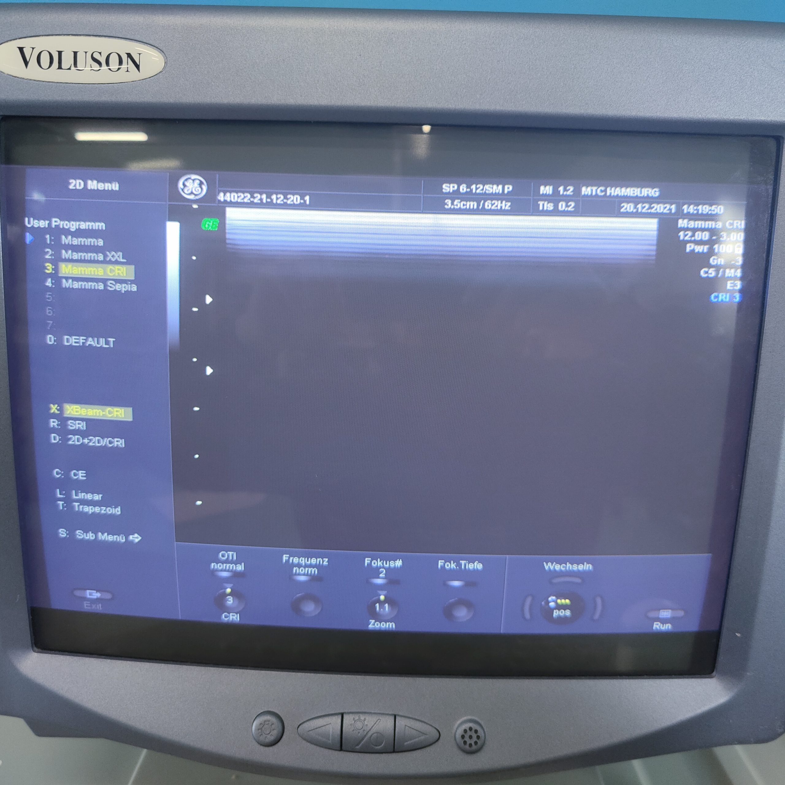 GE Voluson 730 Pro 3D/4D Inkl 03 Sonden und Printer // RAB4-8L , RIC5-9H , SP6-12 DOM 2010 thumbnail 7