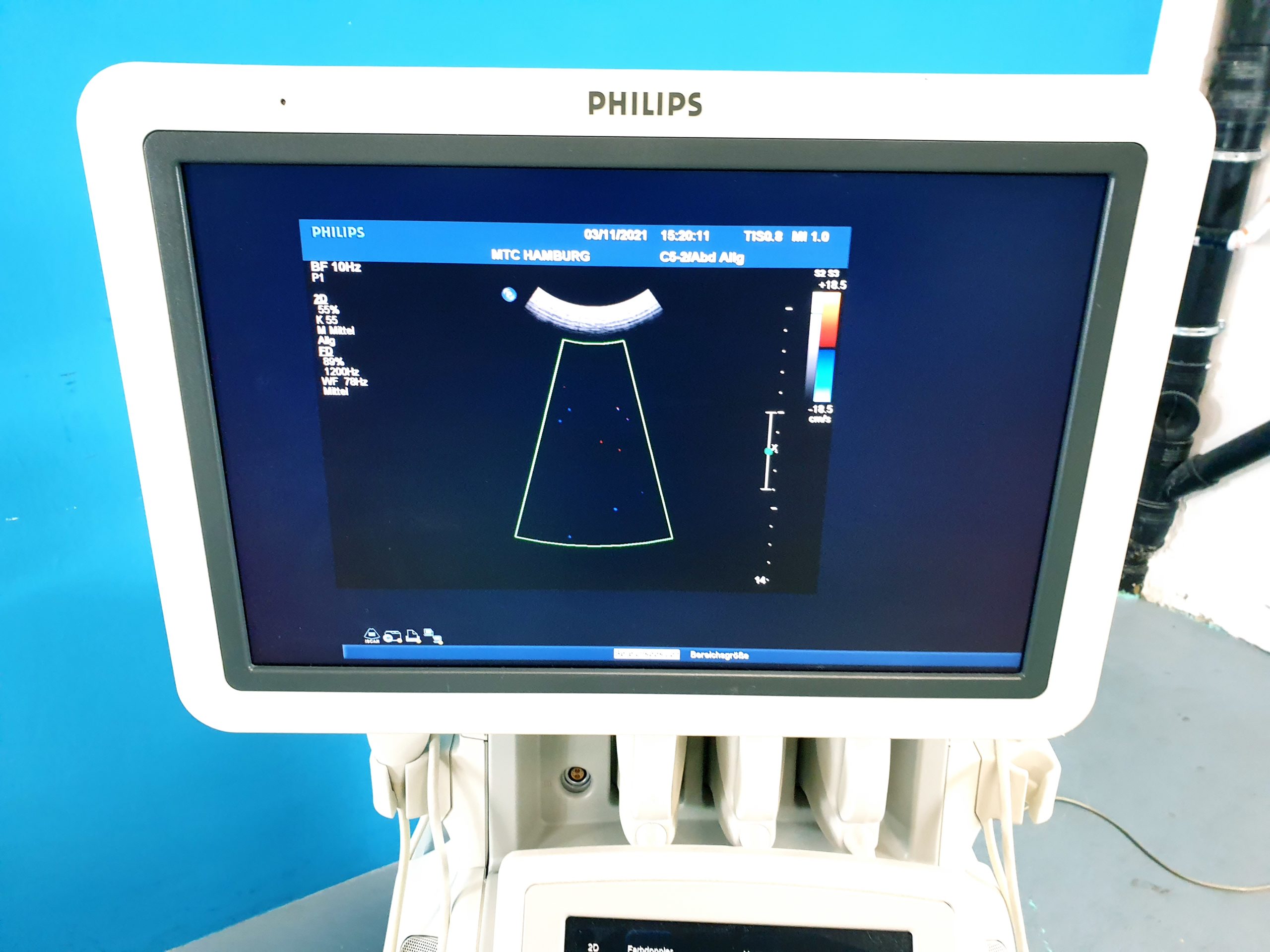 Philips iU22 C5-2 C8-5 L12-5 SW: 4.1.1.58 thumbnail 4
