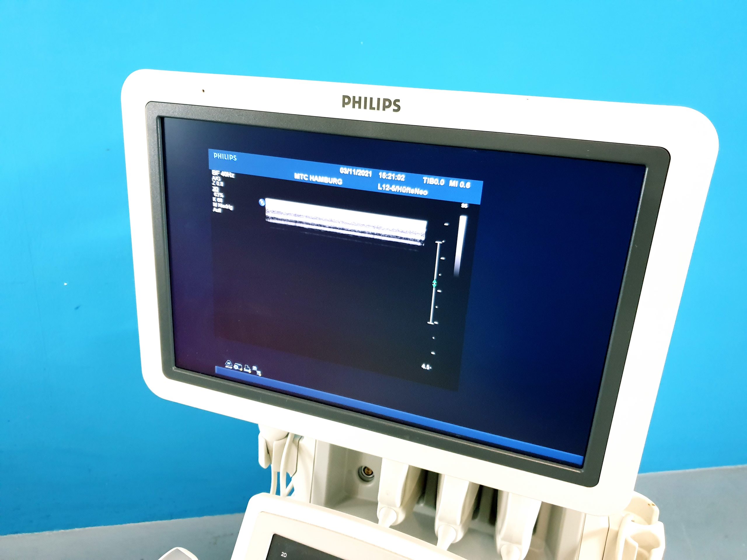 Philips iU22 C5-2 C8-5 L12-5 SW: 4.1.1.58 thumbnail 7