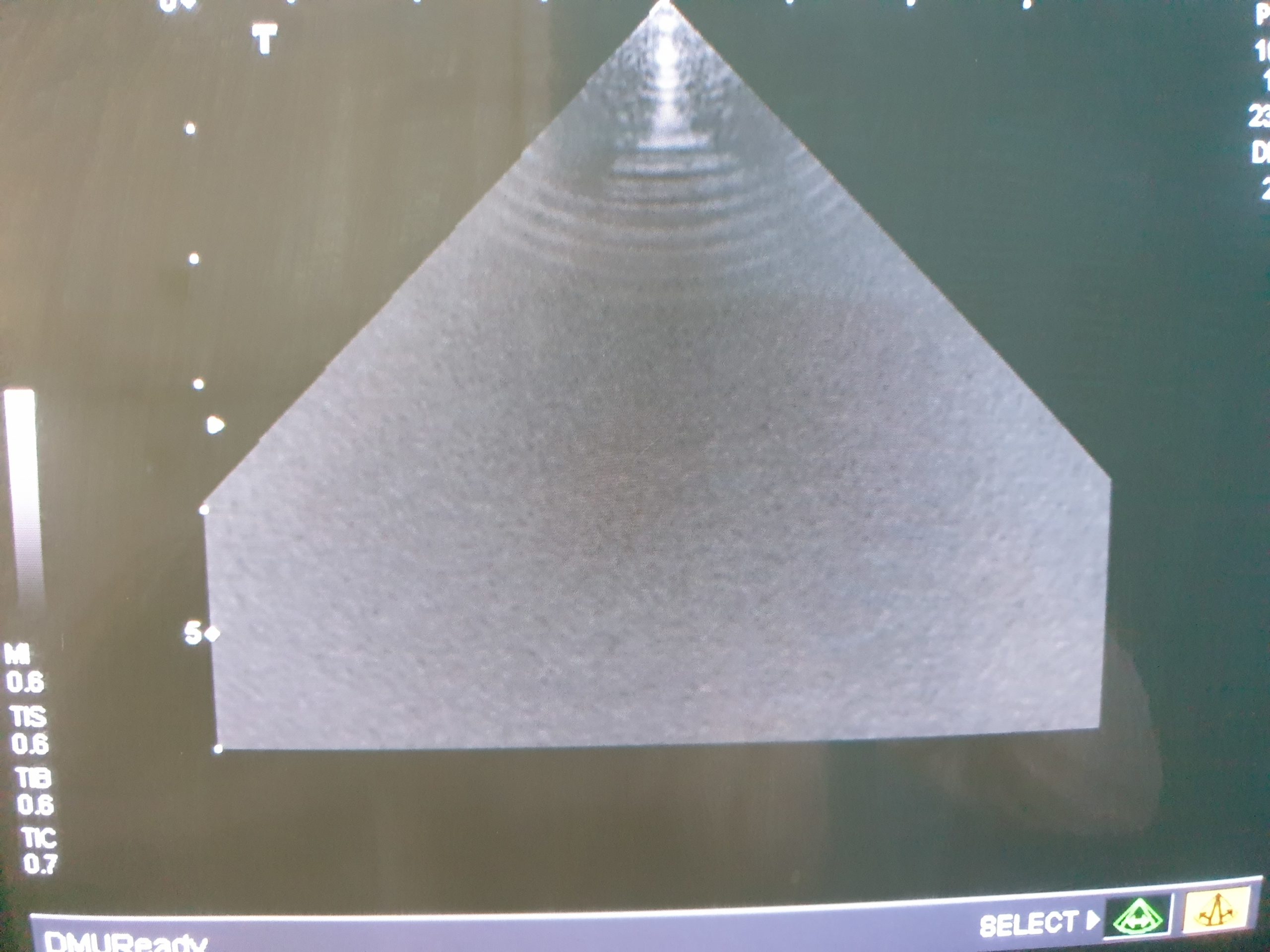 Toshiba PSM-70AT // PSM 70 AT Phased Array Ultrasound Probe thumbnail 2