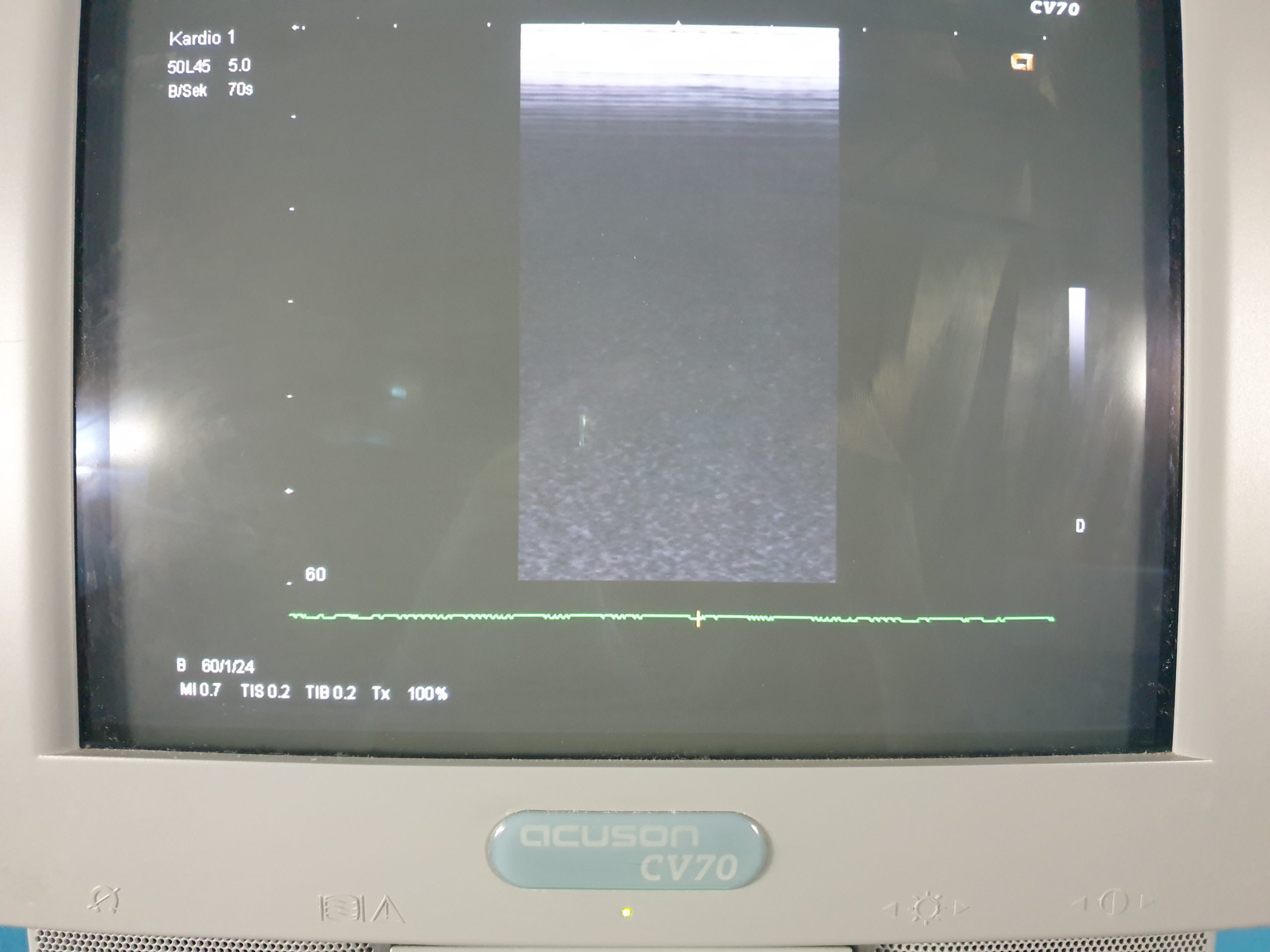 Siemens acuson CV70 // CV 70 C6-2 Konvex + 5.0L45 Linear + P4-2 Echo Kardio DOM 2004 thumbnail 3