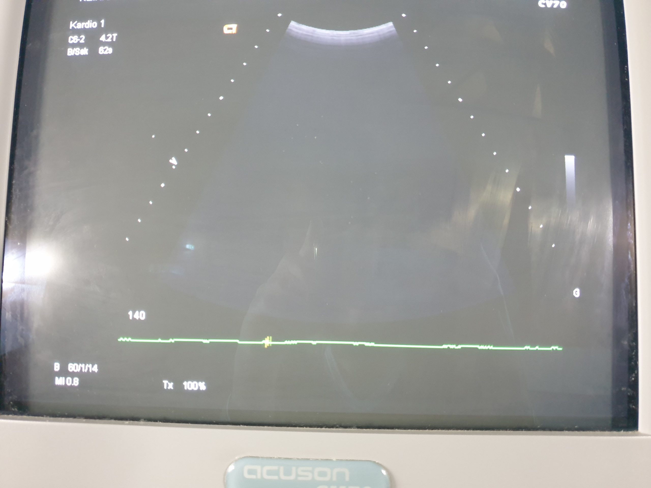 Siemens acuson CV70 // CV 70 C6-2 Konvex + 5.0L45 Linear + P4-2 Echo Kardio DOM 2004 thumbnail 5